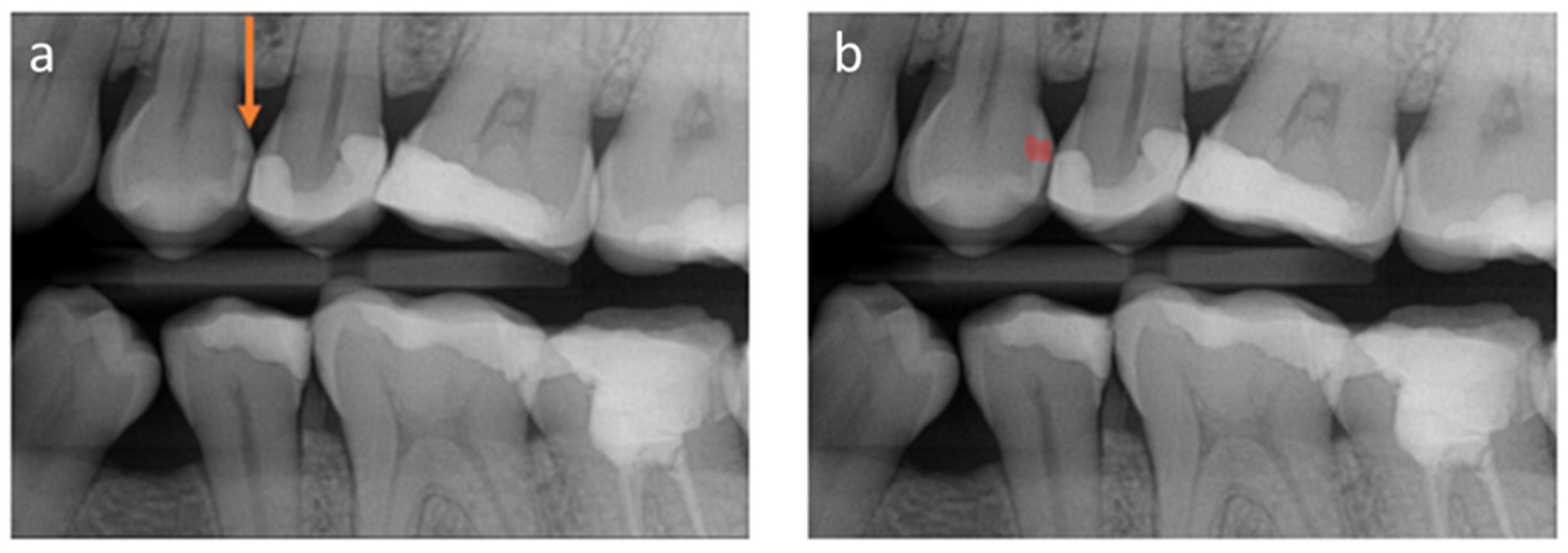 Xray Scan - Frighten Wife KW, PDF