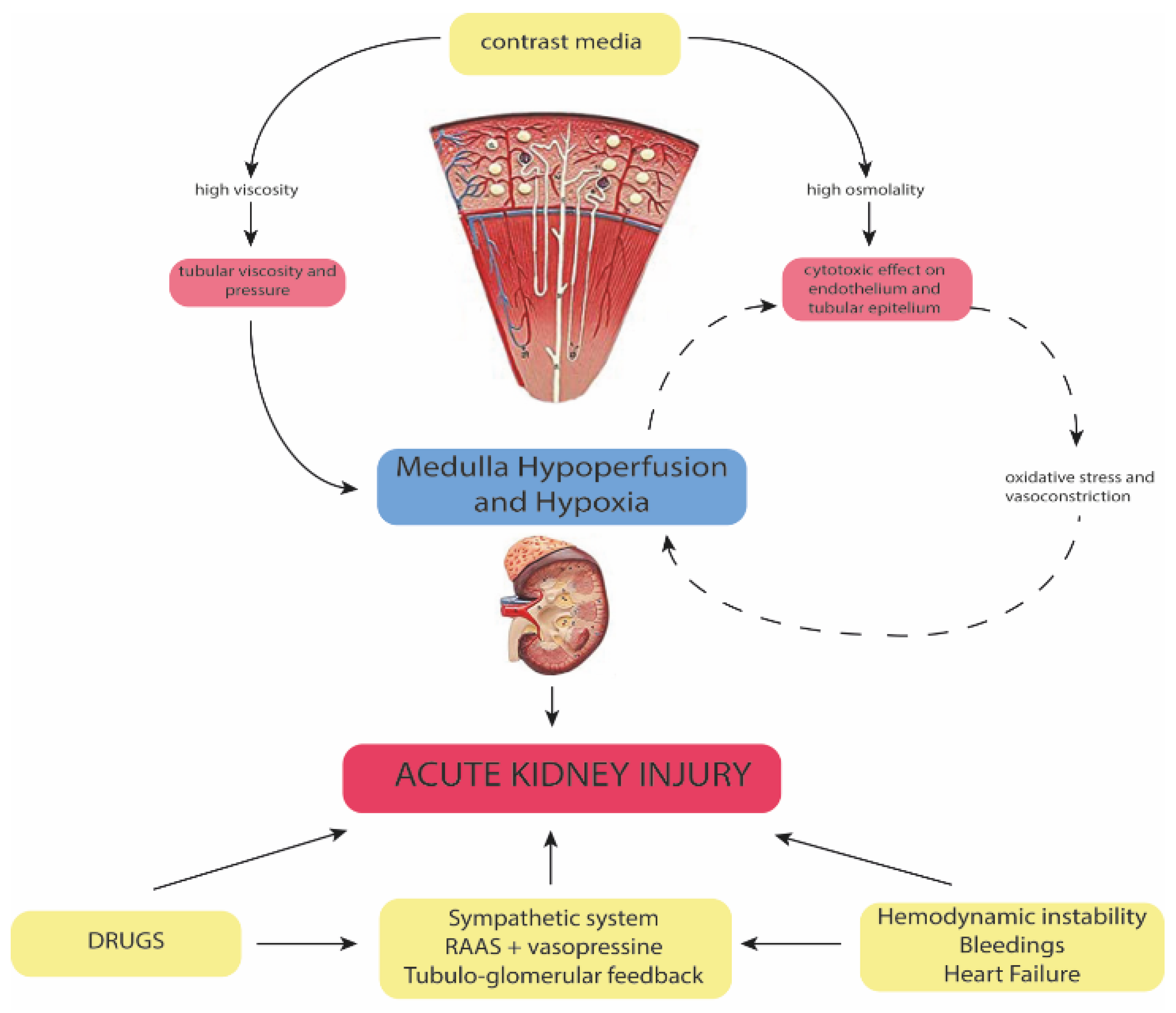 JCM Free Full Text Contrast Associated Acute Kidney Injury jcm-free-full-text-contrast-associated-acute-kidney-injury