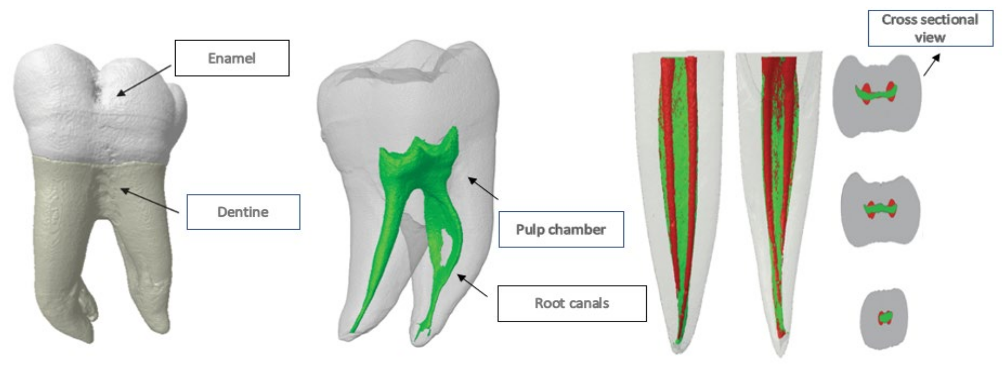 3D Visual Glossary of Terminology in Root and Root Canal Anatomy