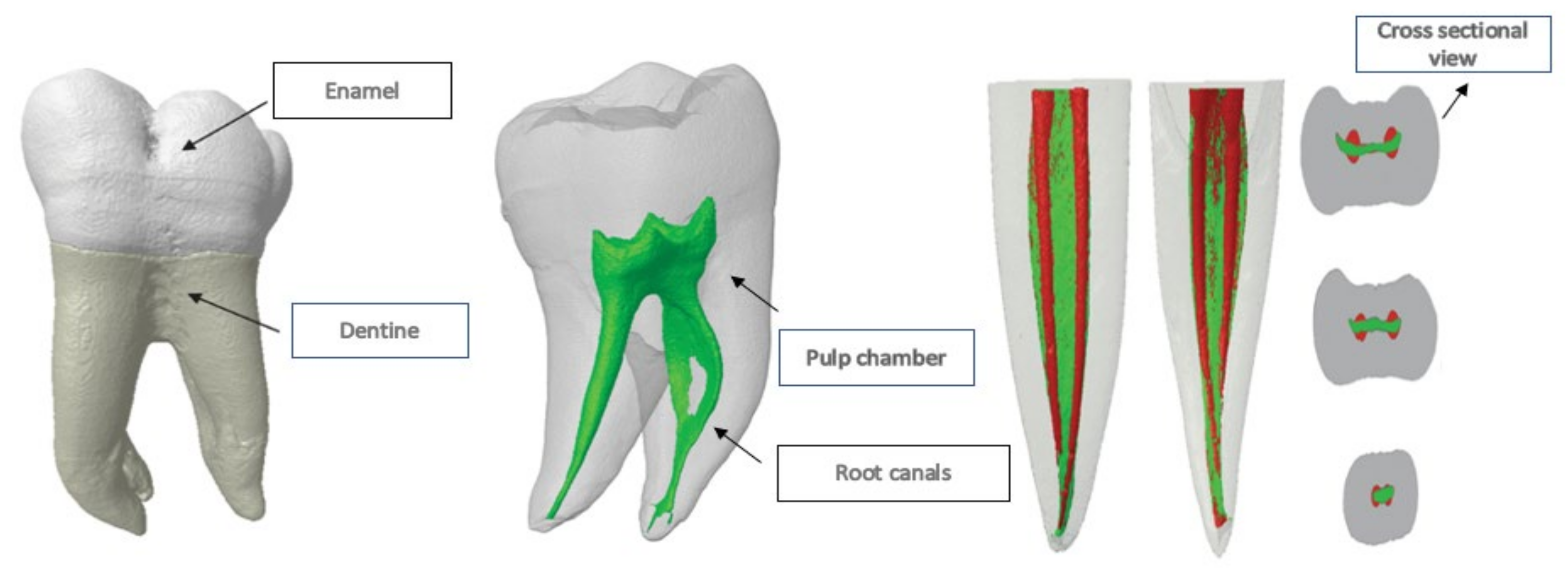 aspecto He reconocido famoso root canal anatomy project Inconveniencia ...