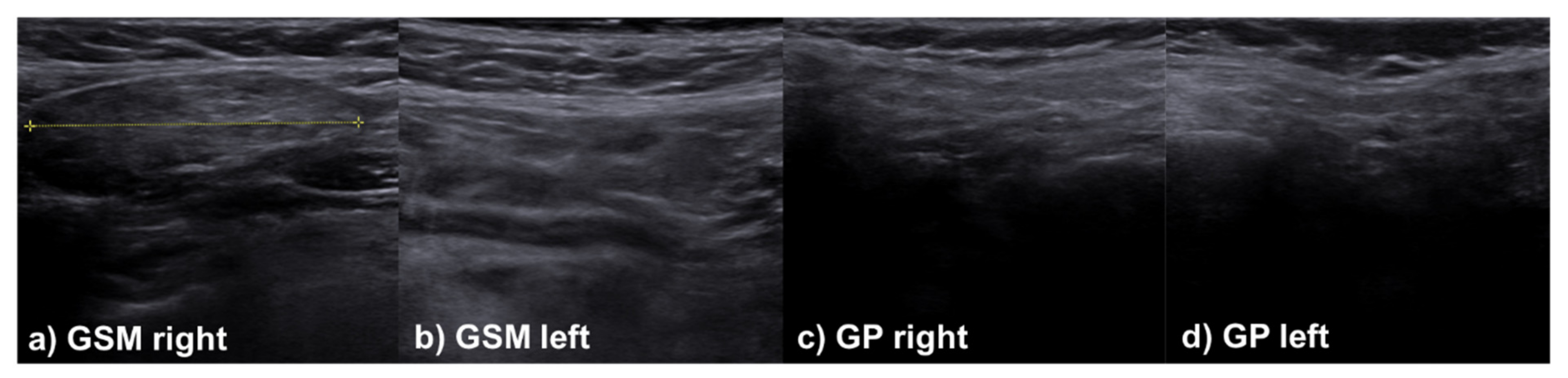 Jcm 11 02292 g001 Jcm 11 02292 g001