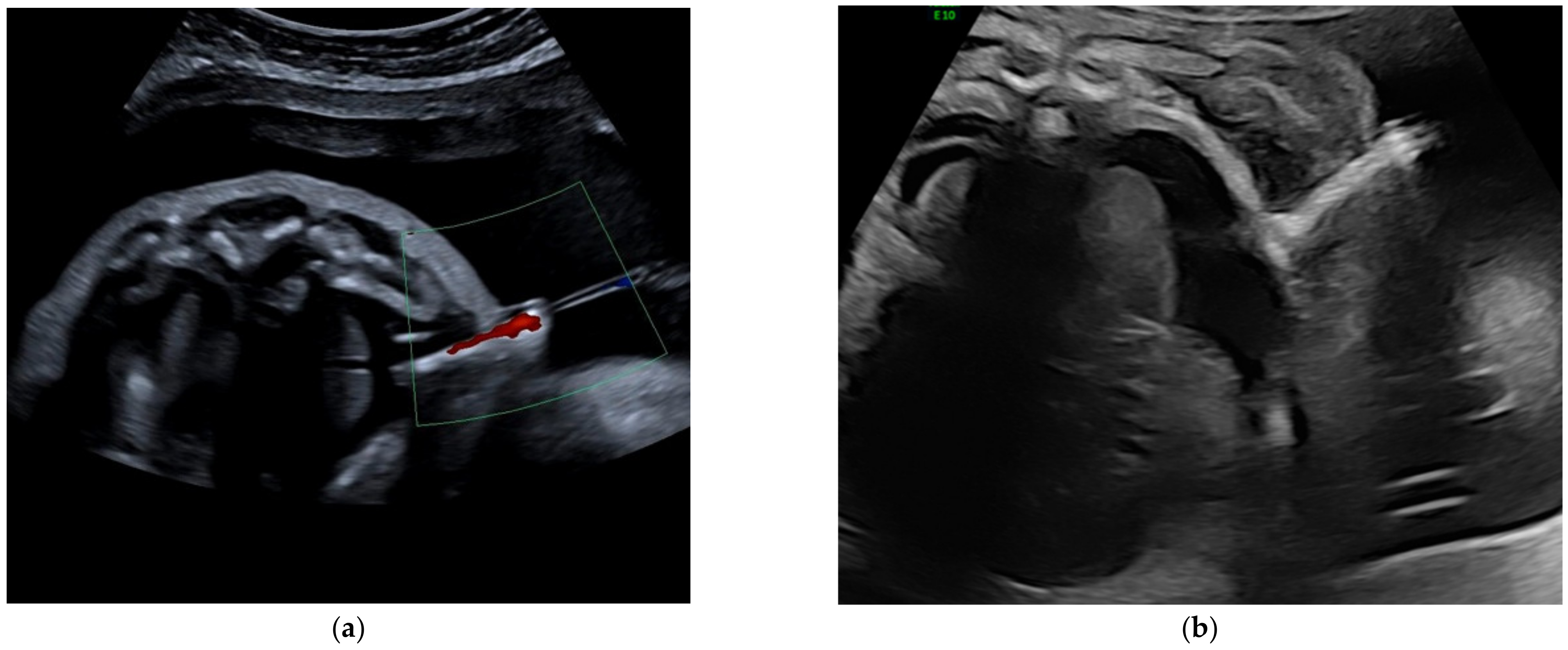 Jcm 11 02312 g002 550