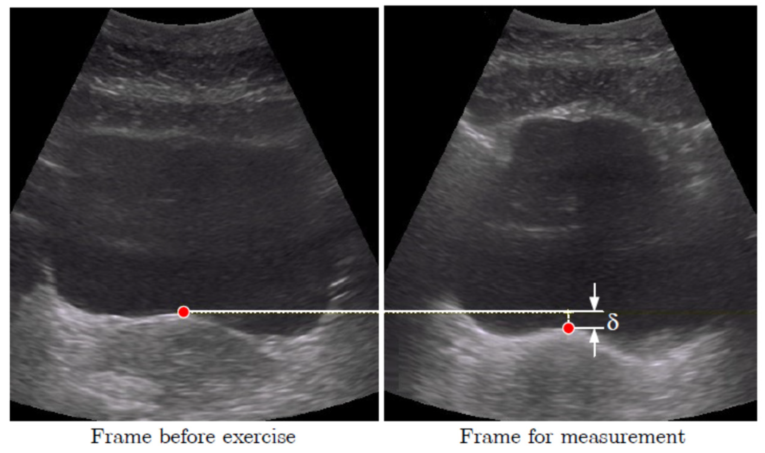 Jcm 11 02319 g001 550