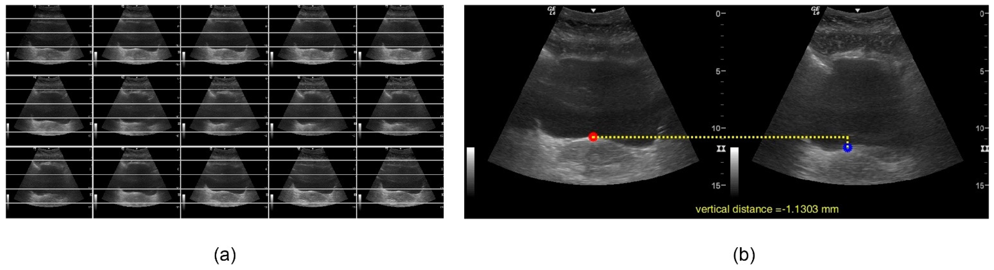 Jcm 11 02319 g004 550