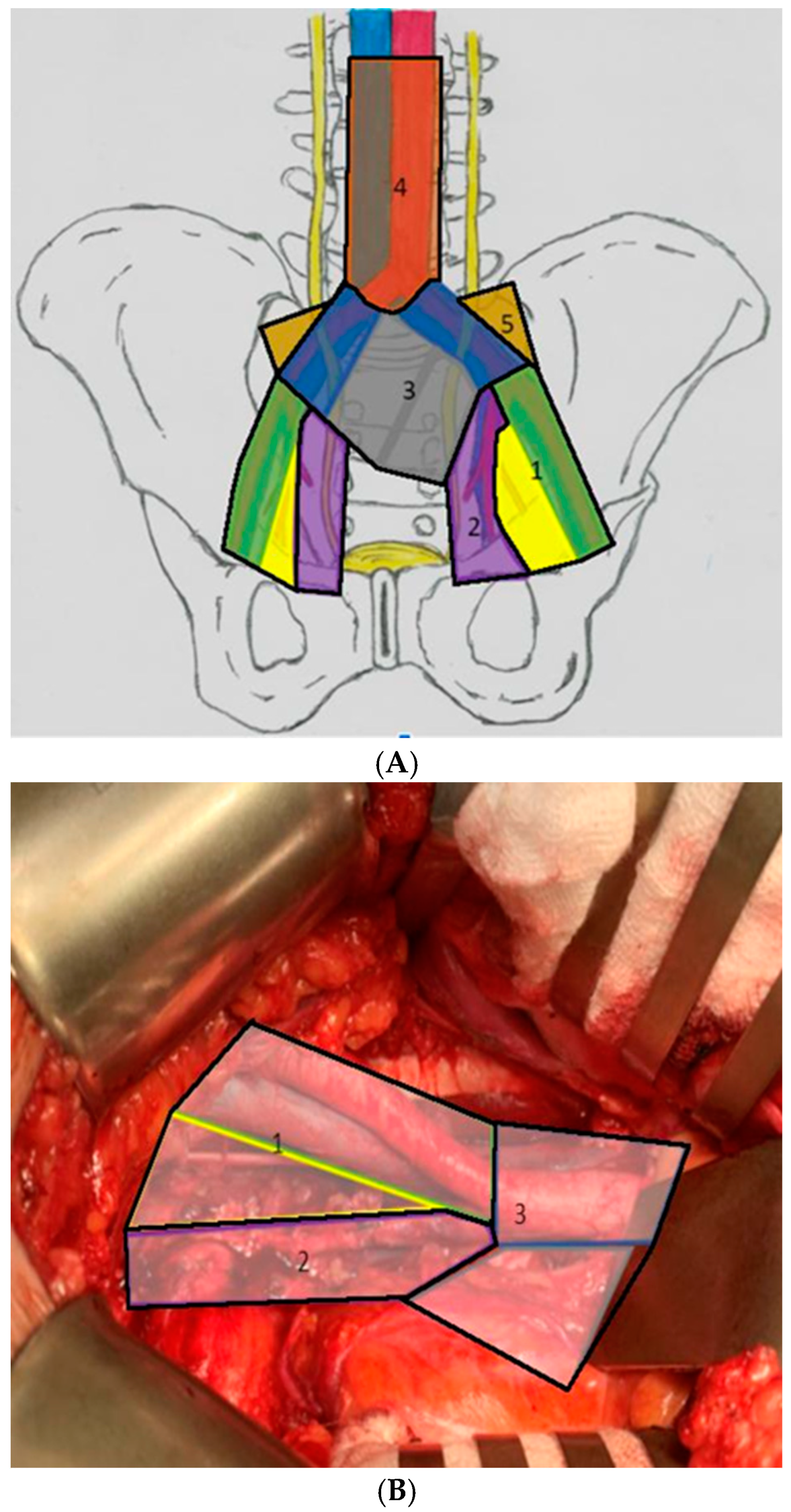 Jcm 11 02343 g001 Jcm 11 02343 g001