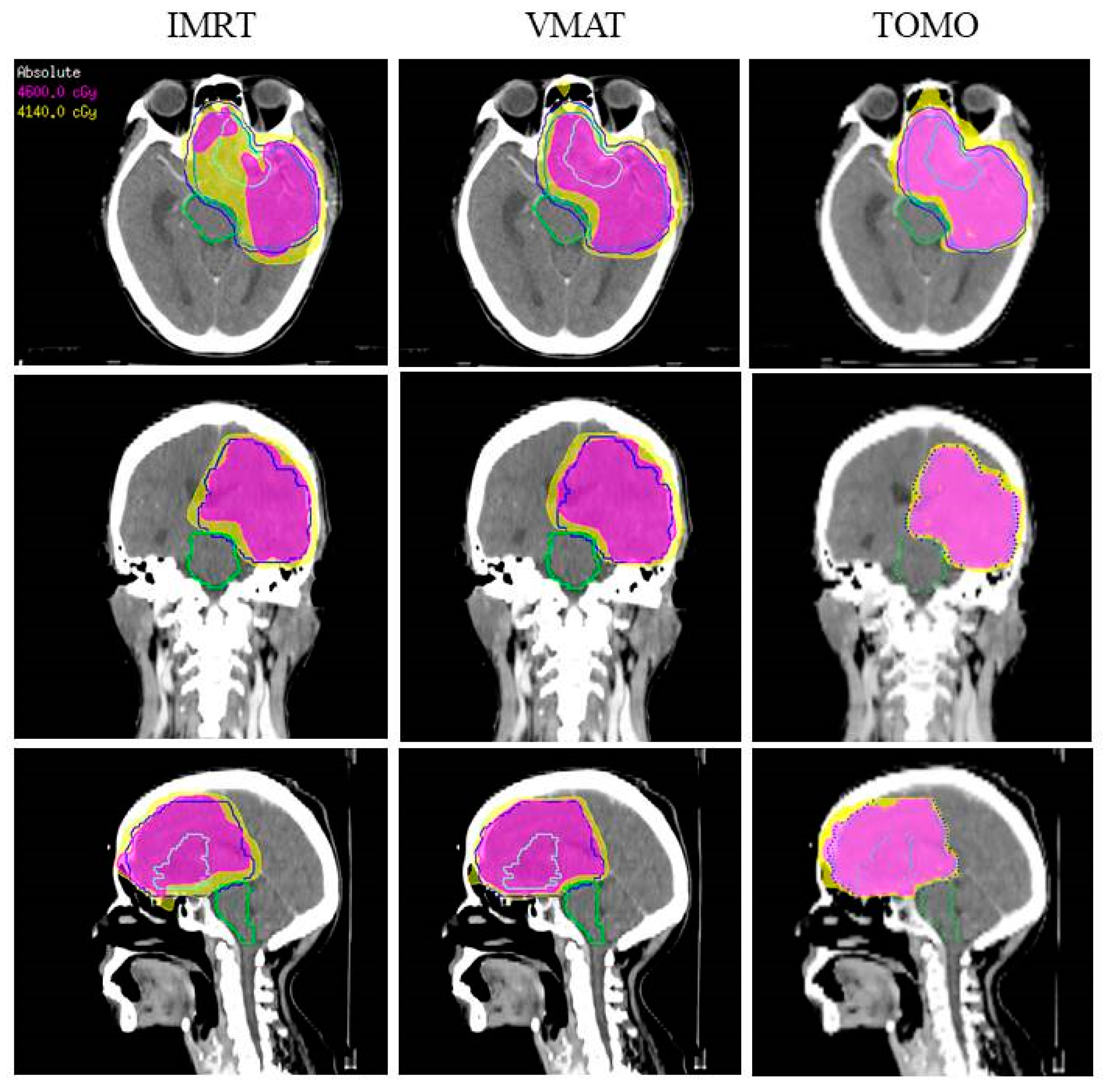 Jcm 11 02413 g003 Jcm 11 02413 g003