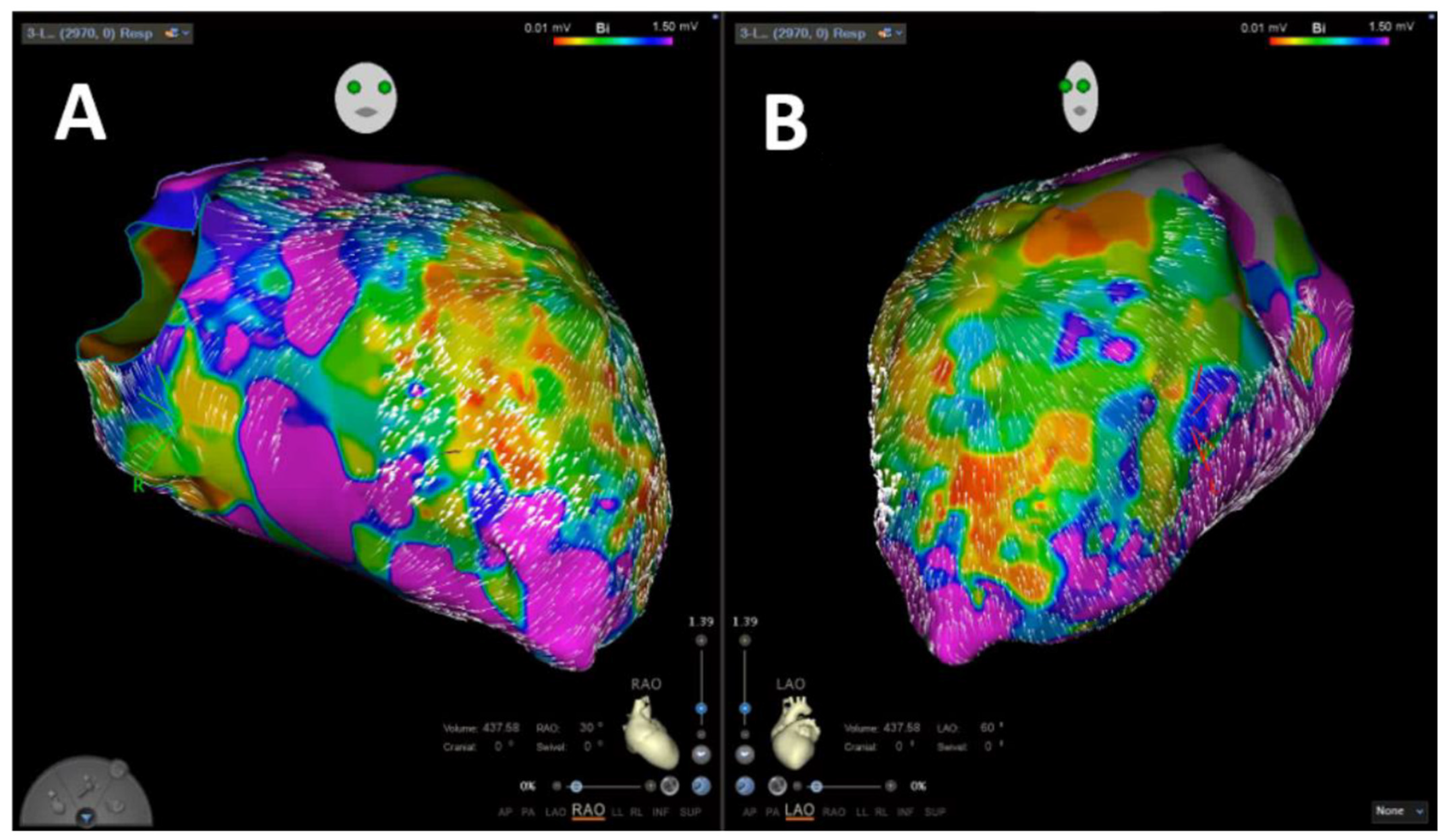 Jcm 11 02418 g003 550