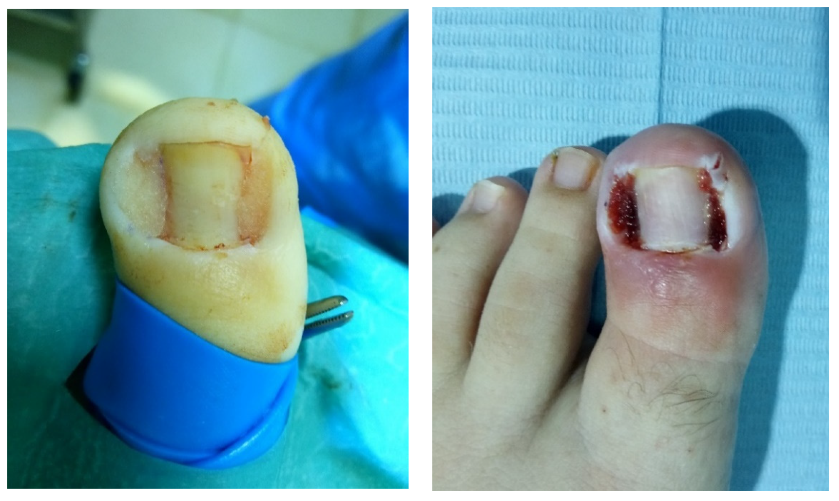 Jcm 11 02420 g003 550