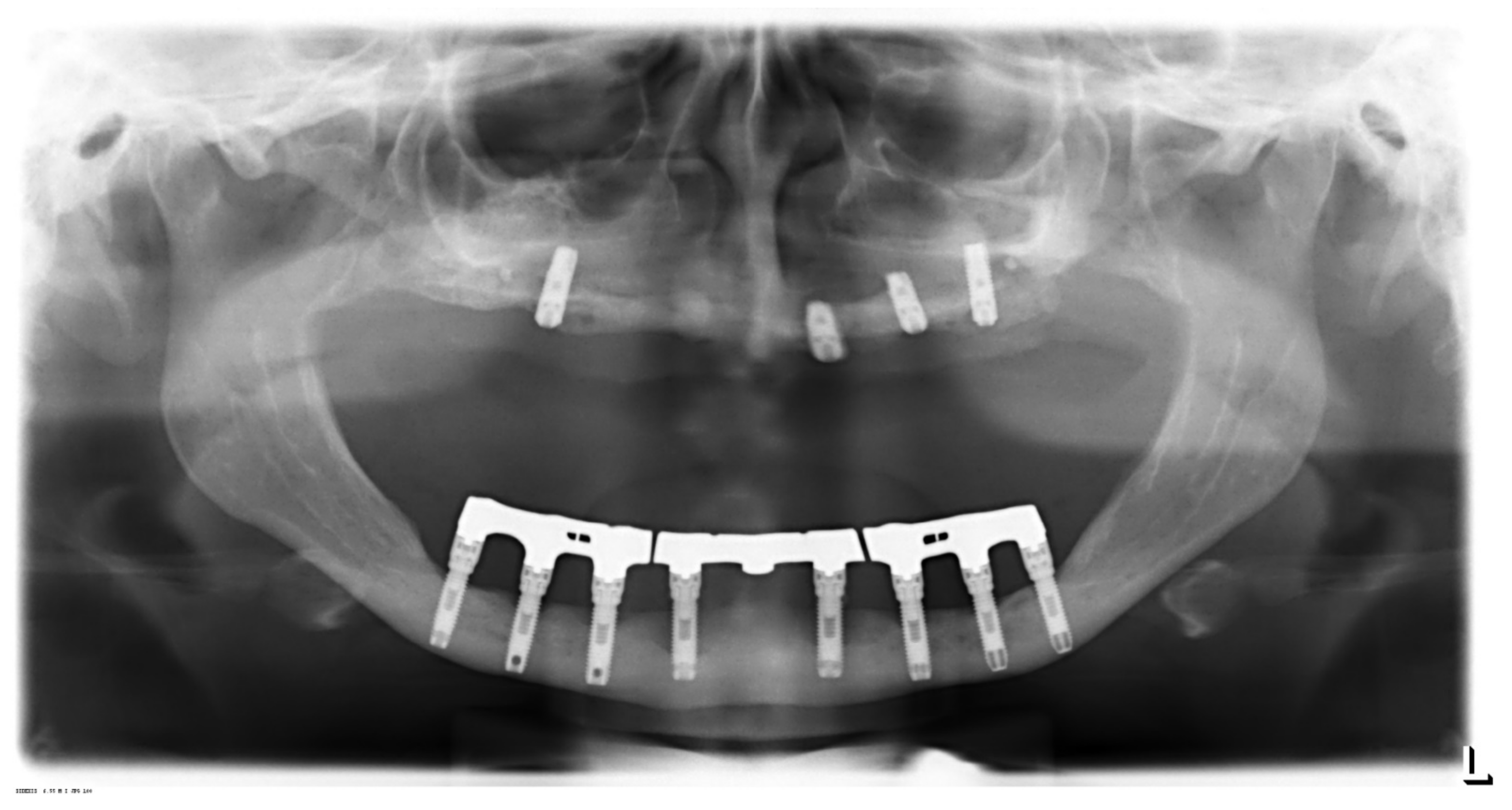 corona 50 denti x bicicletta willer