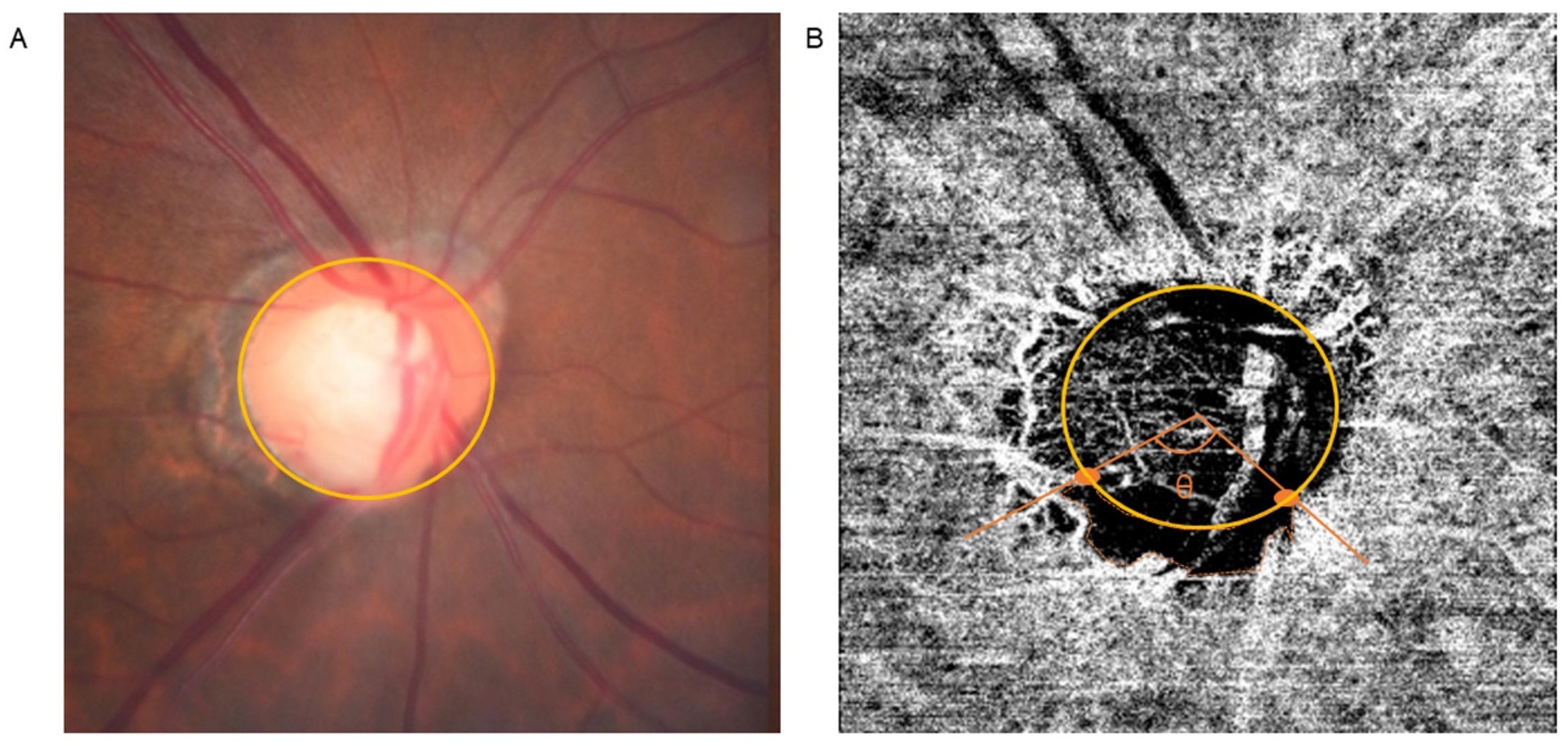 Jcm 11 02478 g001 Jcm 11 02478 g001