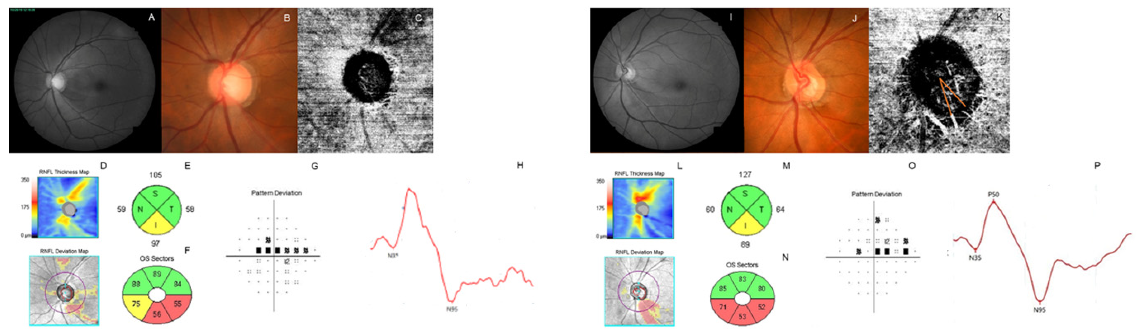 Jcm 11 02478 g002 Jcm 11 02478 g002
