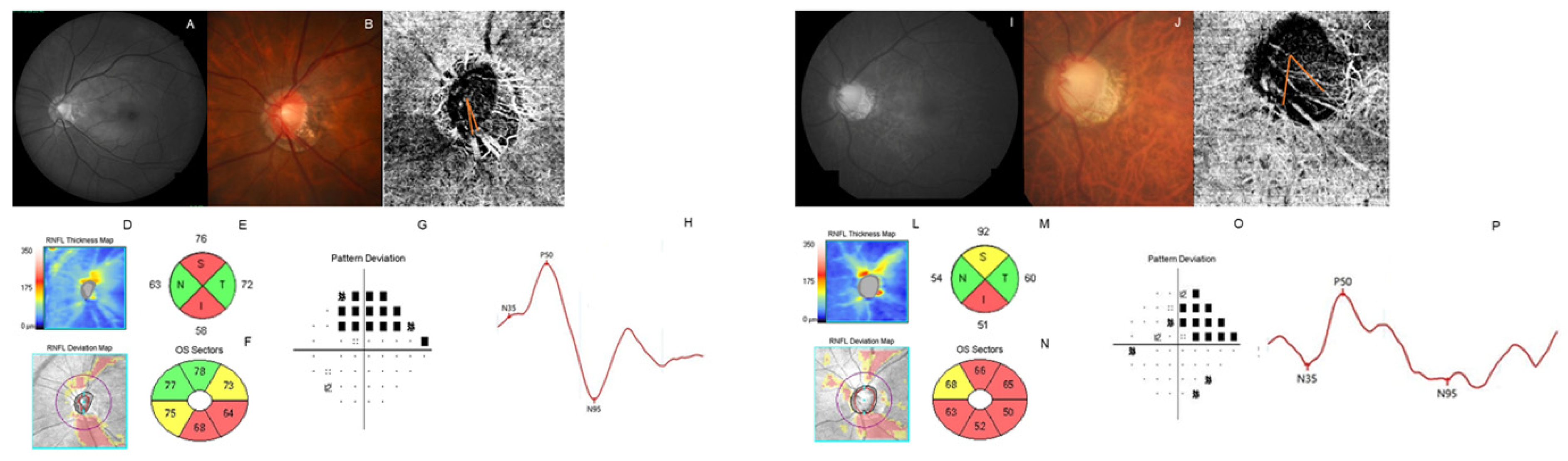 Jcm 11 02478 g003 Jcm 11 02478 g003