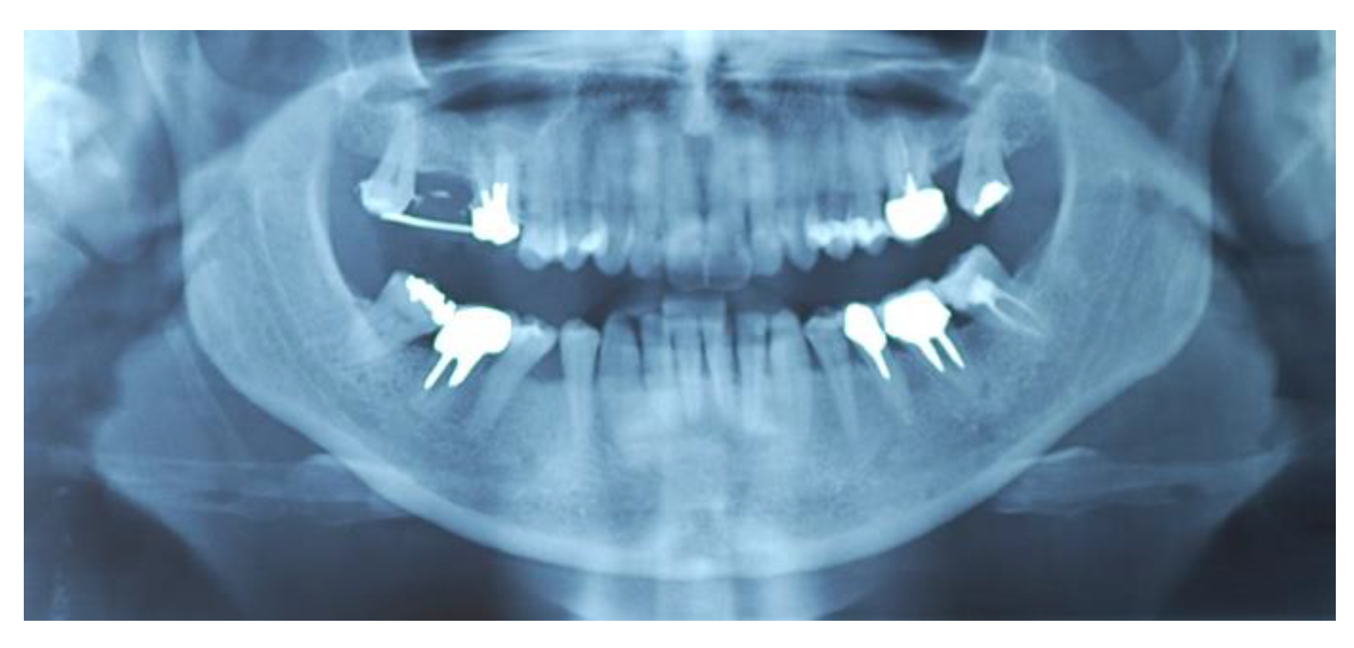 Jcm 11 02491 g001 Jcm 11 02491 g001