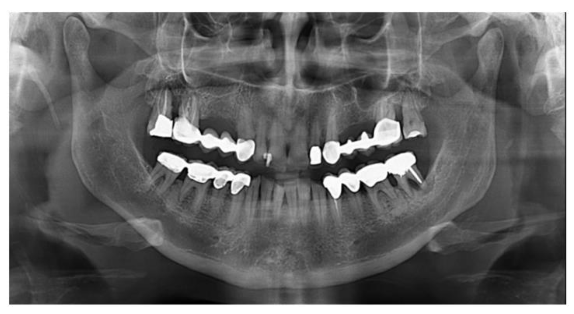 Jcm 11 02491 g002 Jcm 11 02491 g002