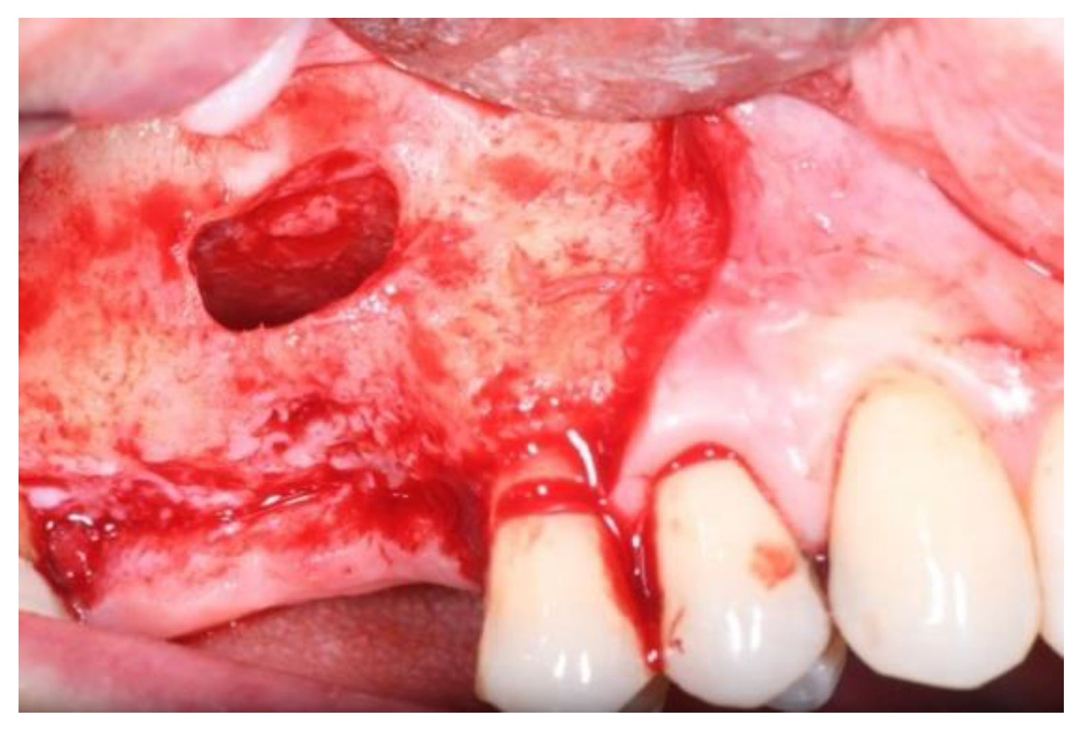 Jcm 11 02491 g003 Jcm 11 02491 g003