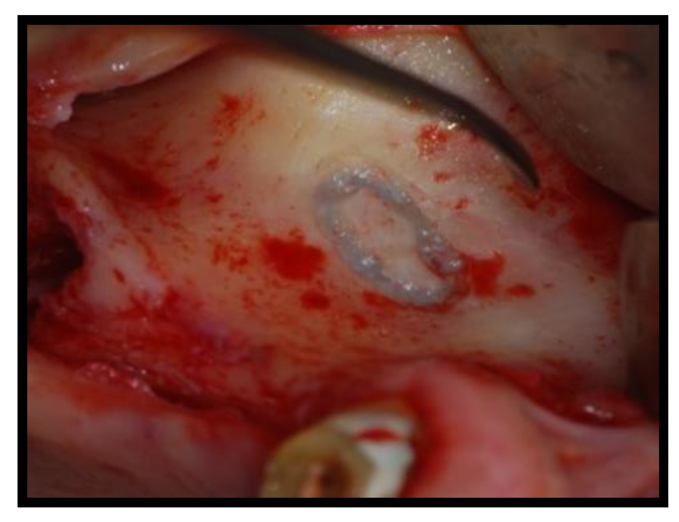 Jcm 11 02491 g004 Jcm 11 02491 g004