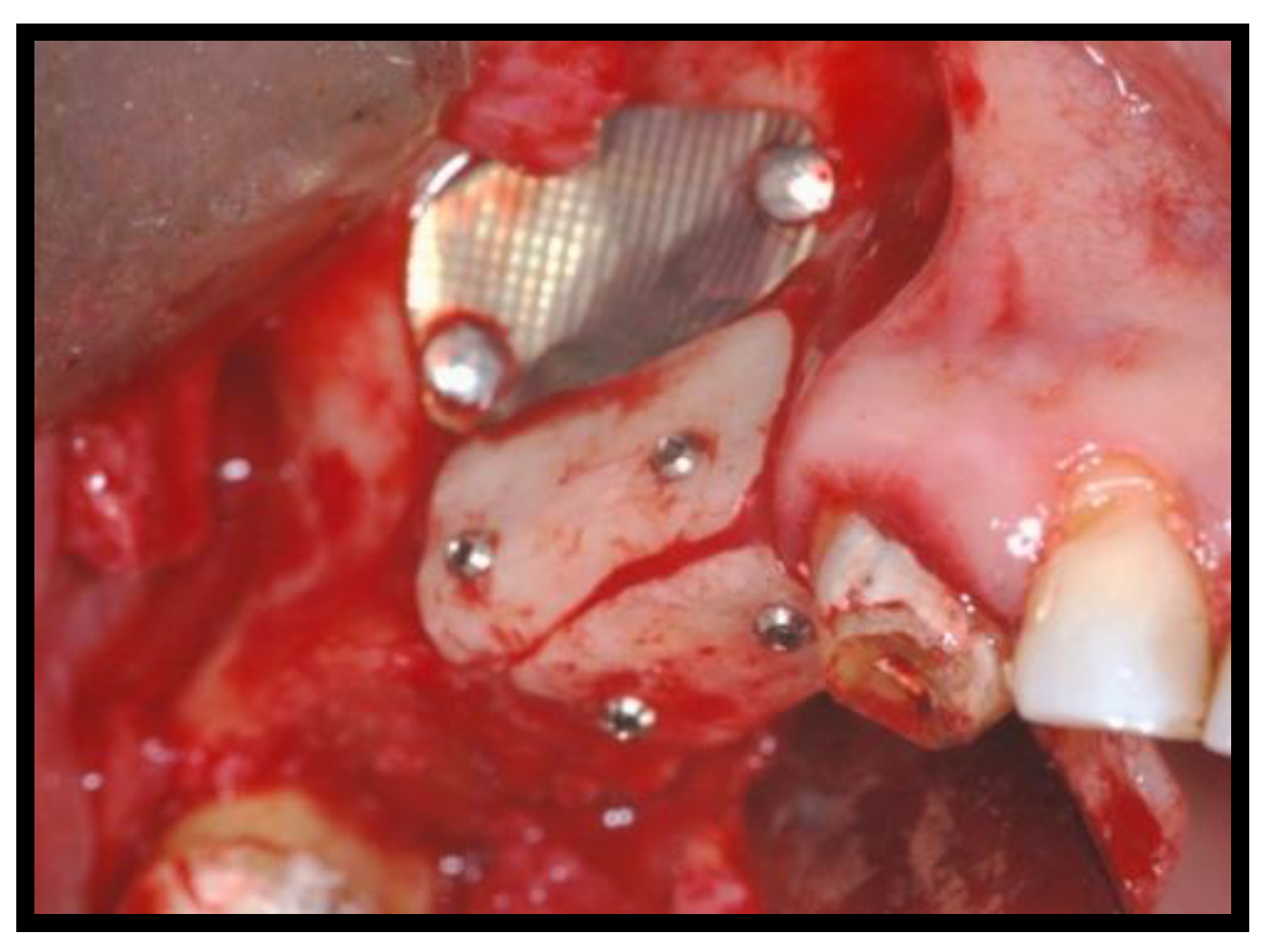 Jcm 11 02491 g008 Jcm 11 02491 g008