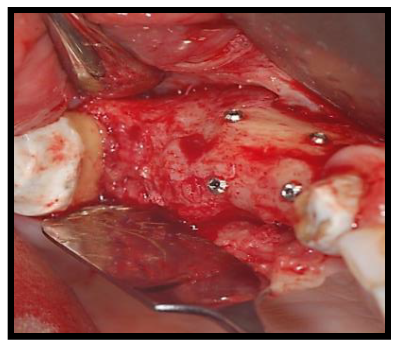 Jcm 11 02491 g010 Jcm 11 02491 g010