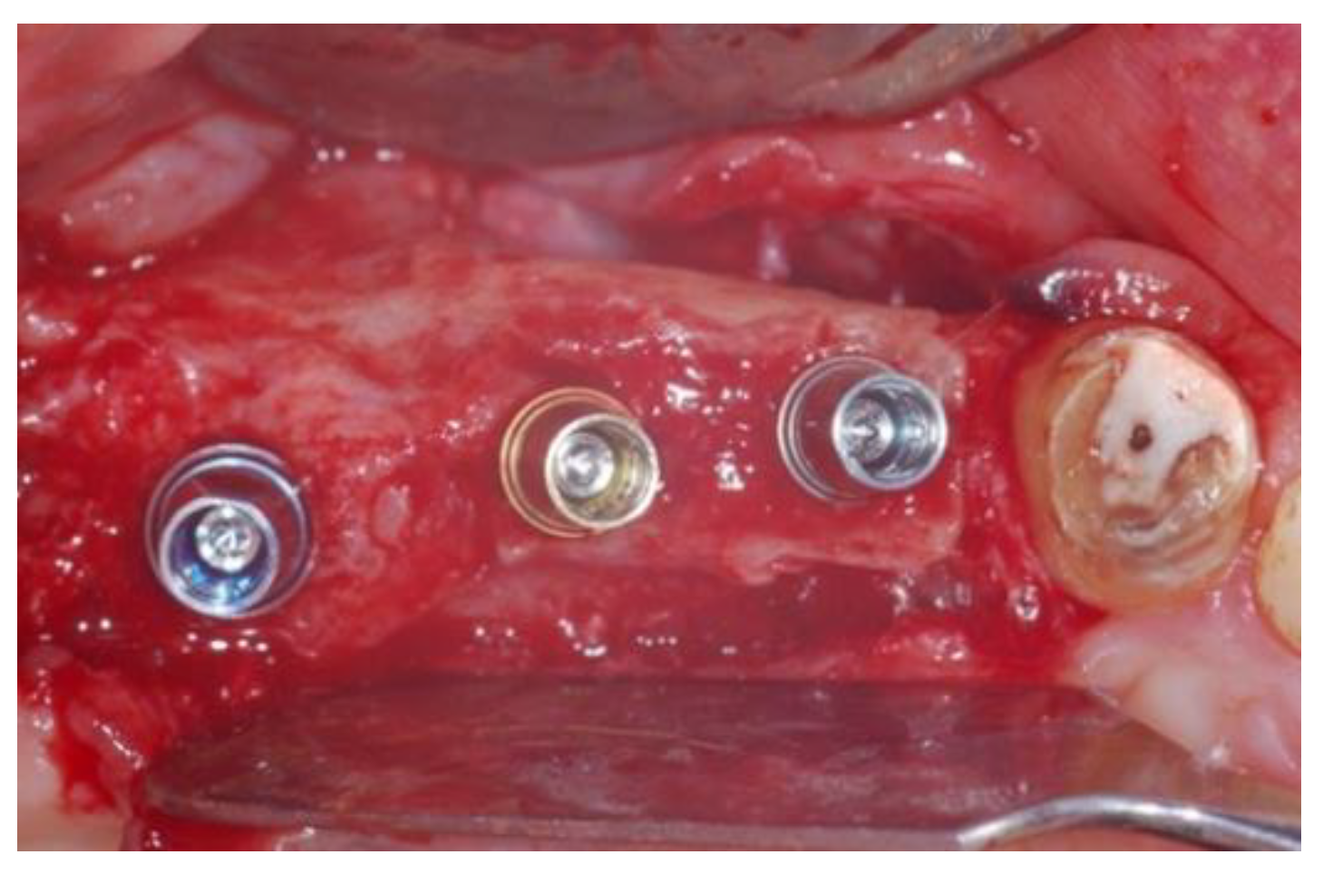 Jcm 11 02491 g012 Jcm 11 02491 g012