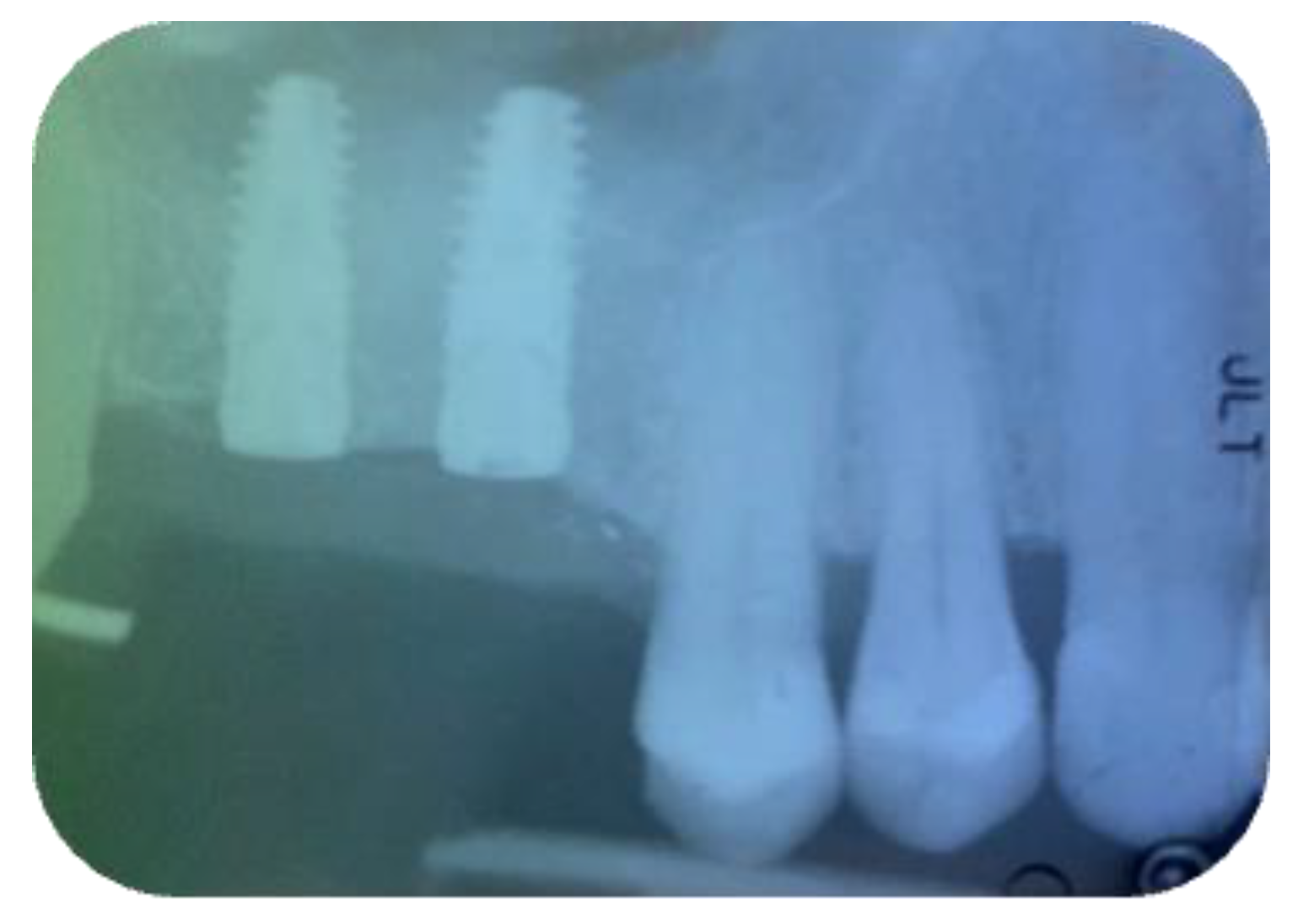 Jcm 11 02491 g013 Jcm 11 02491 g013