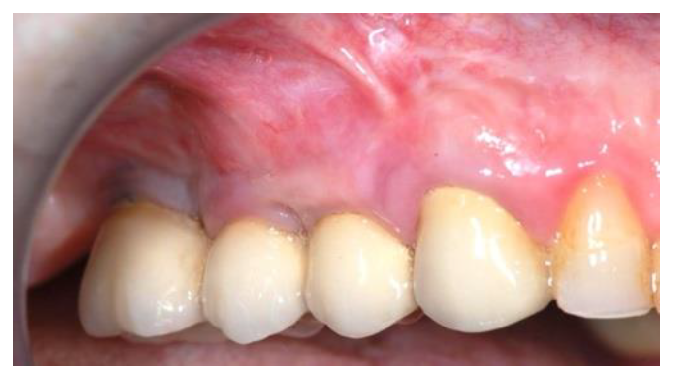 Jcm 11 02491 g018 Jcm 11 02491 g018