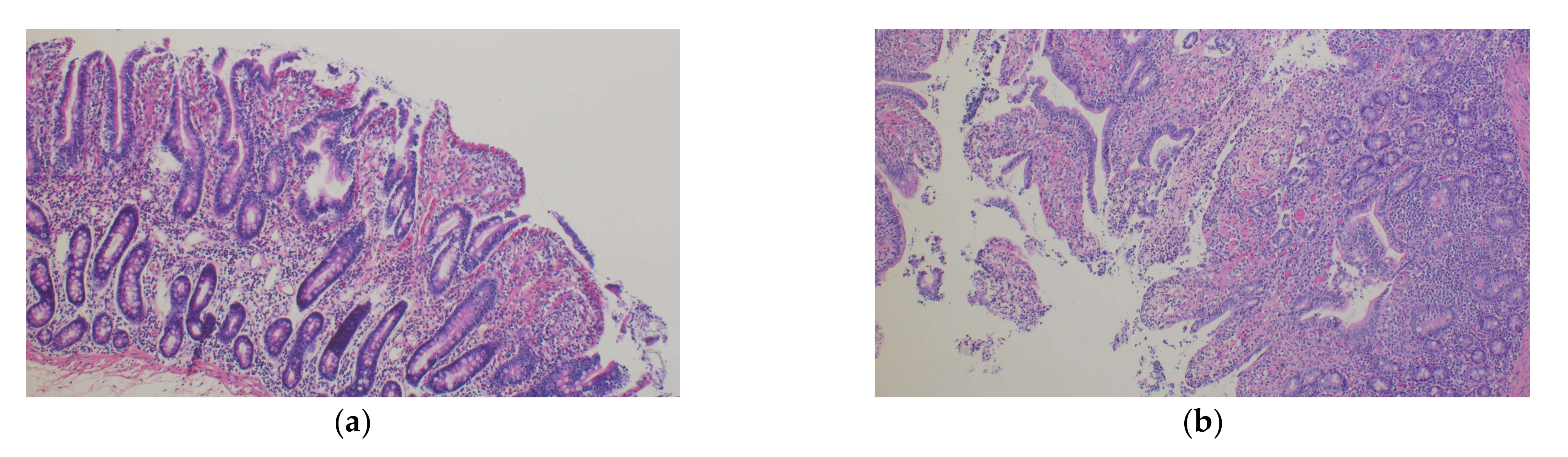 Jcm 11 02515 g002 550