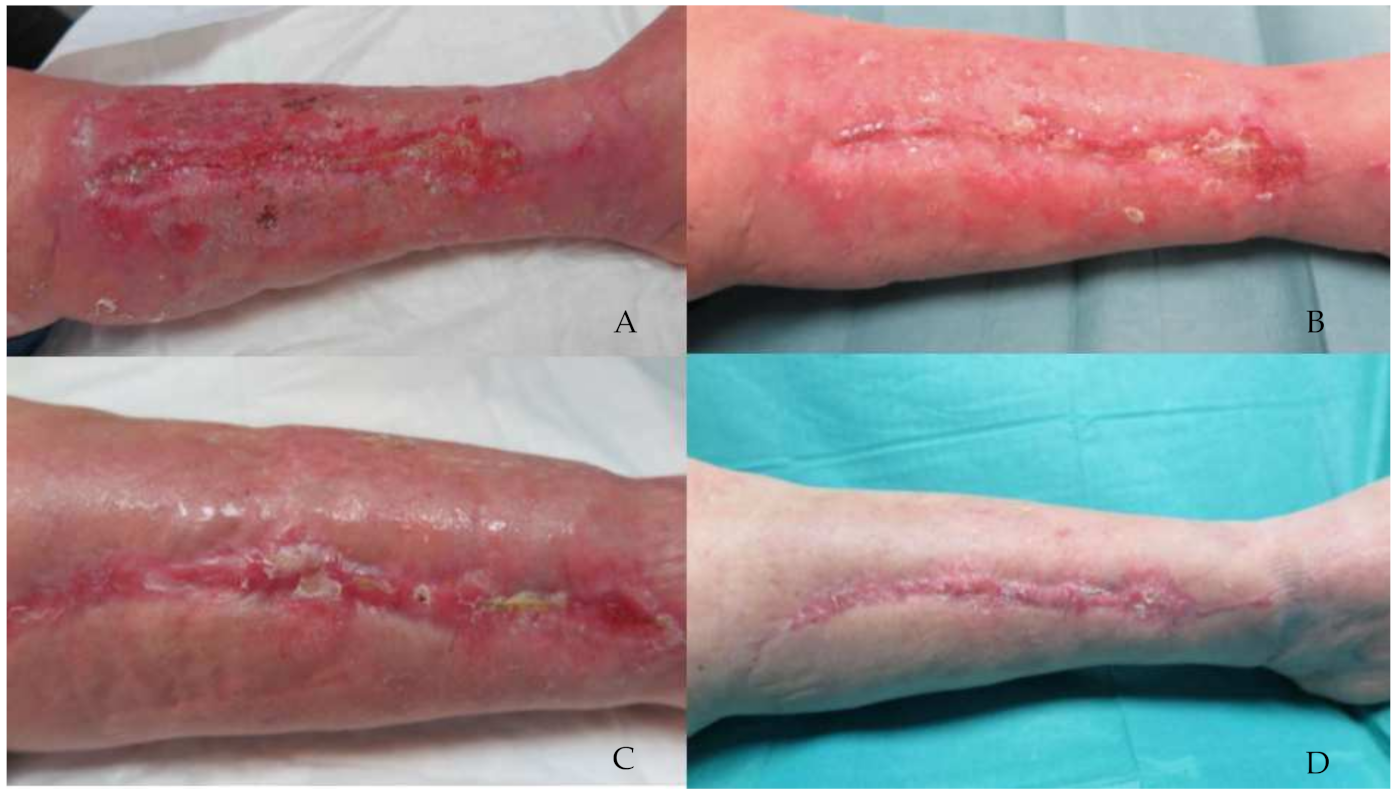 Jcm 11 02518 g003 550