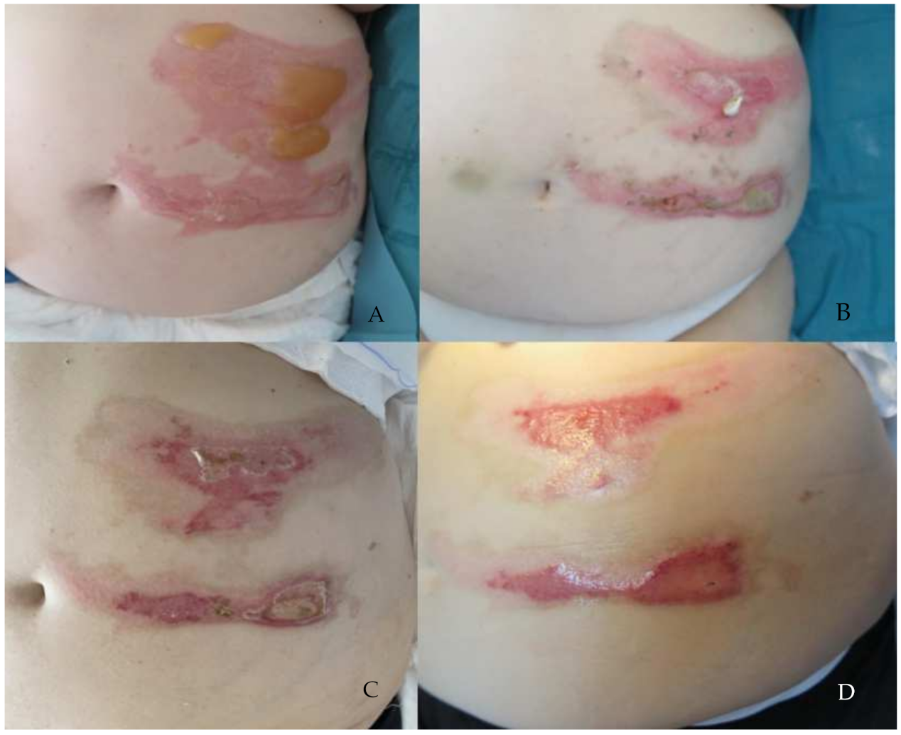 Jcm 11 02518 g004 550