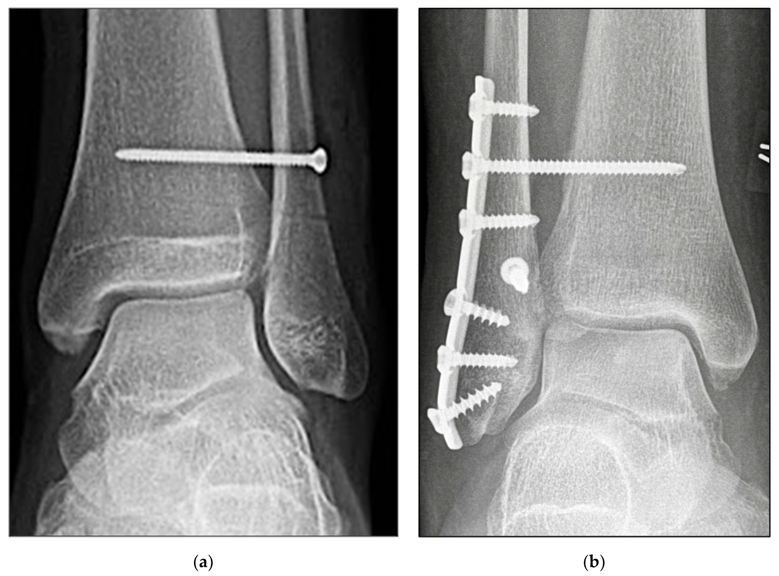 Jcm 11 02524 g003 550