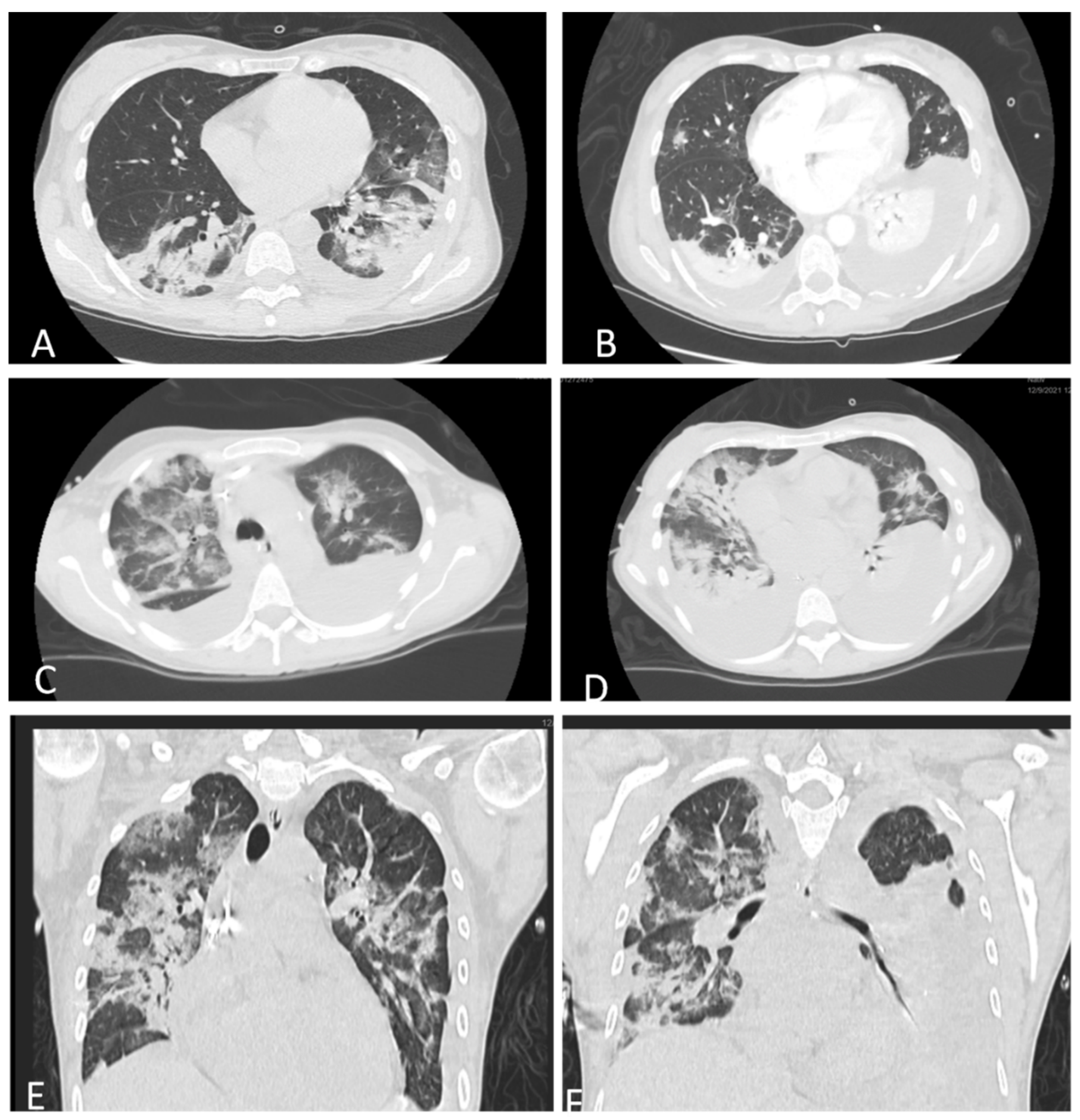 Jcm 11 02554 g002 550