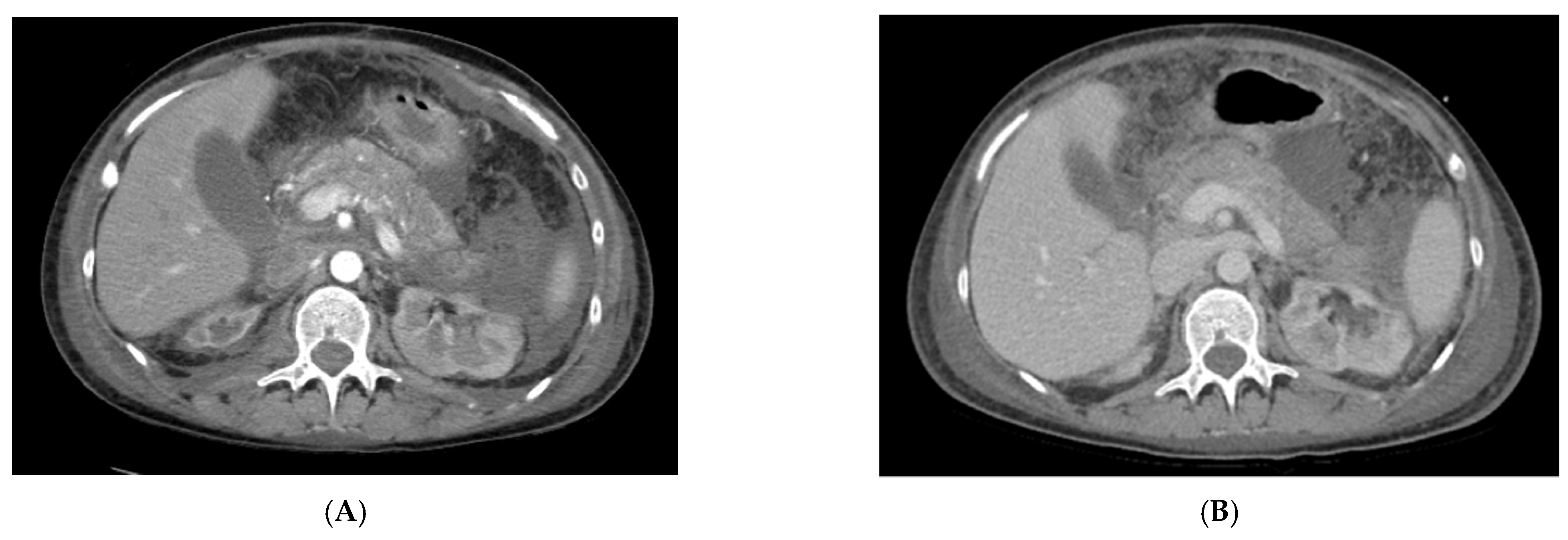 Jcm 11 02554 g003 550