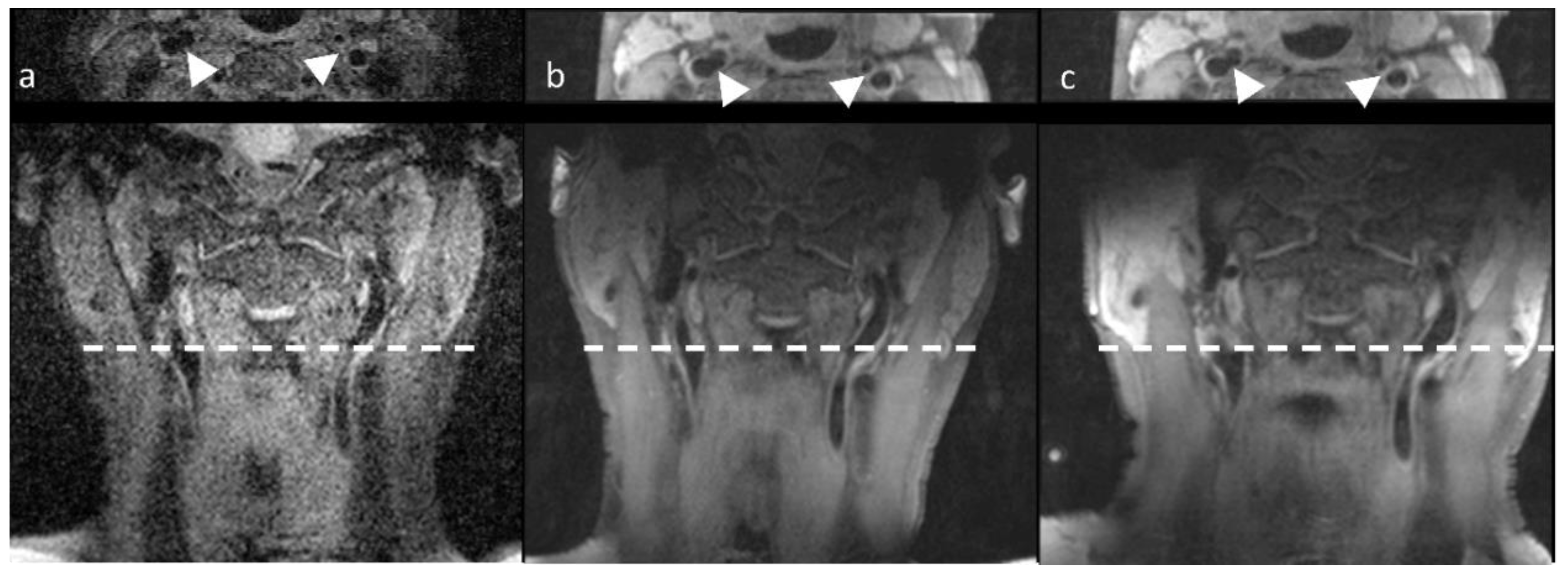 Jcm 11 02569 g003 550