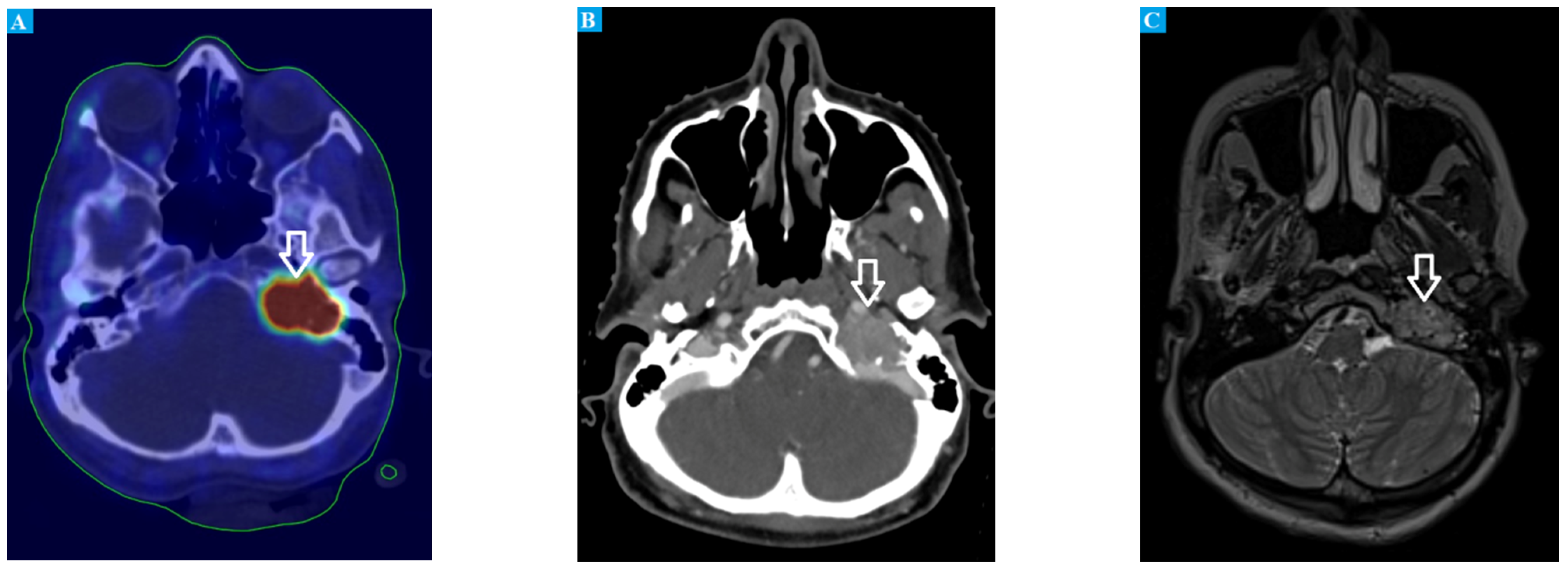 Jcm 11 02591 g002 Jcm 11 02591 g002
