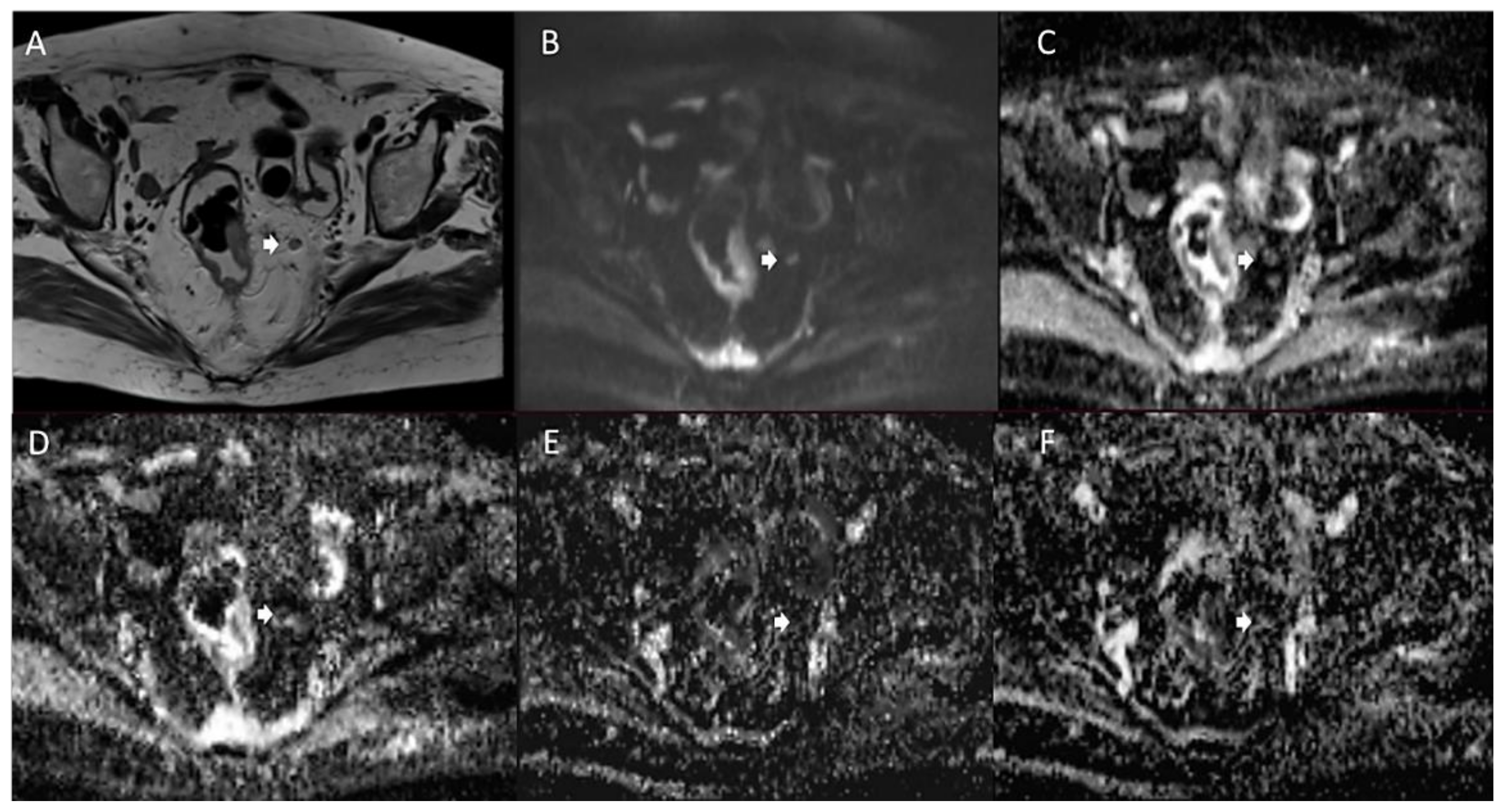Jcm 11 02599 g003 550
