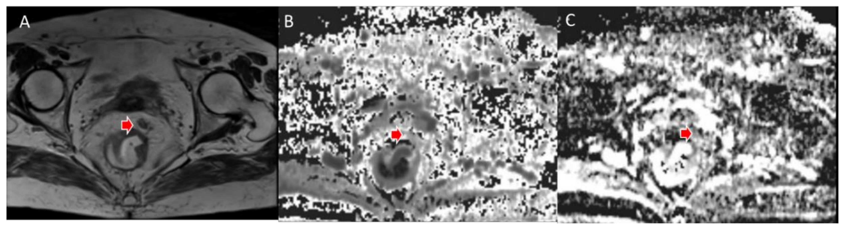 Jcm 11 02599 g004 550