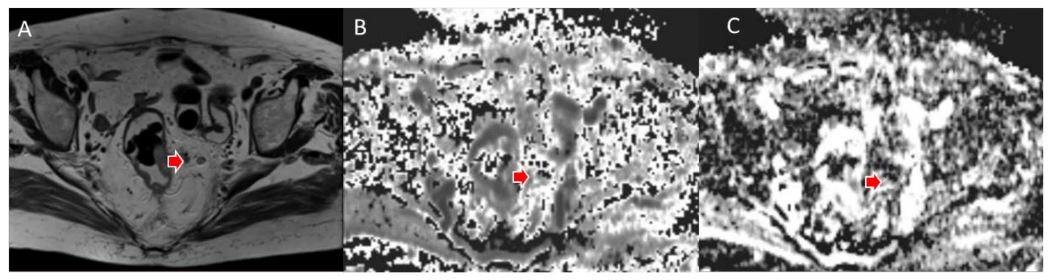 Jcm 11 02599 g005 550