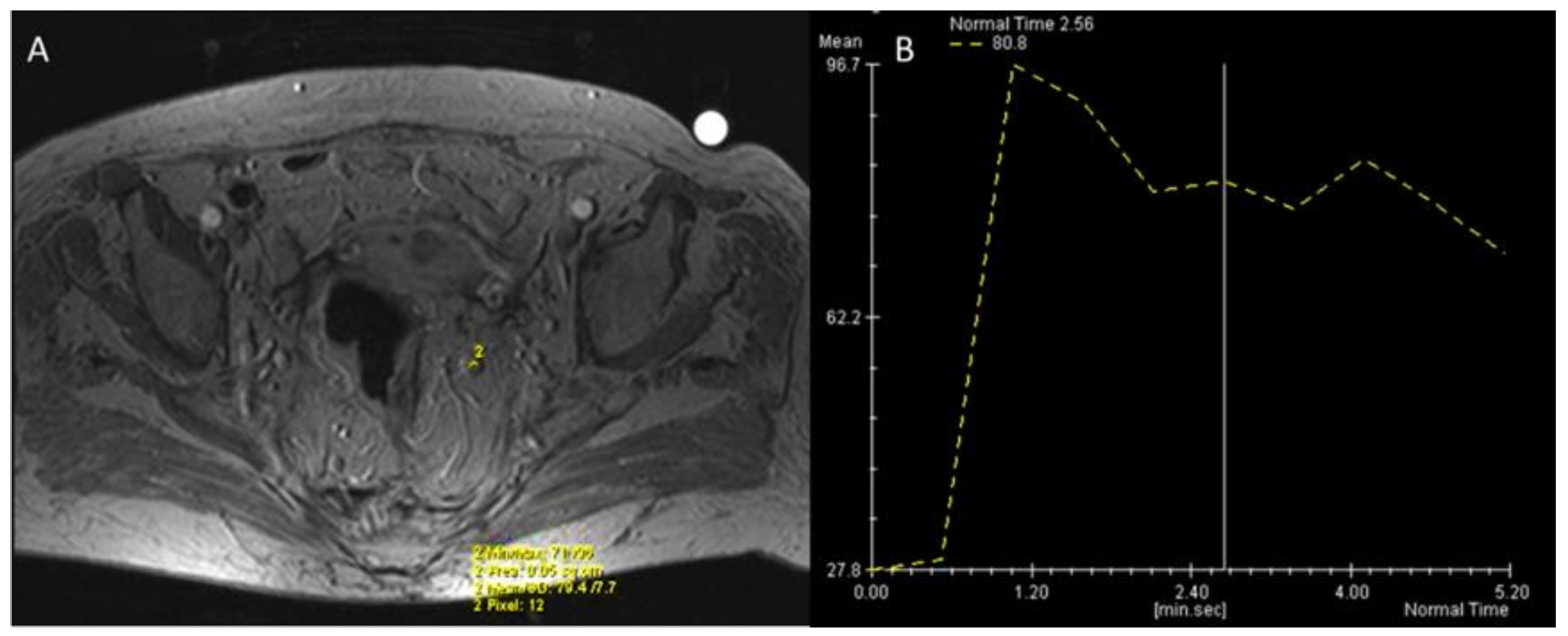 Jcm 11 02599 g007 550