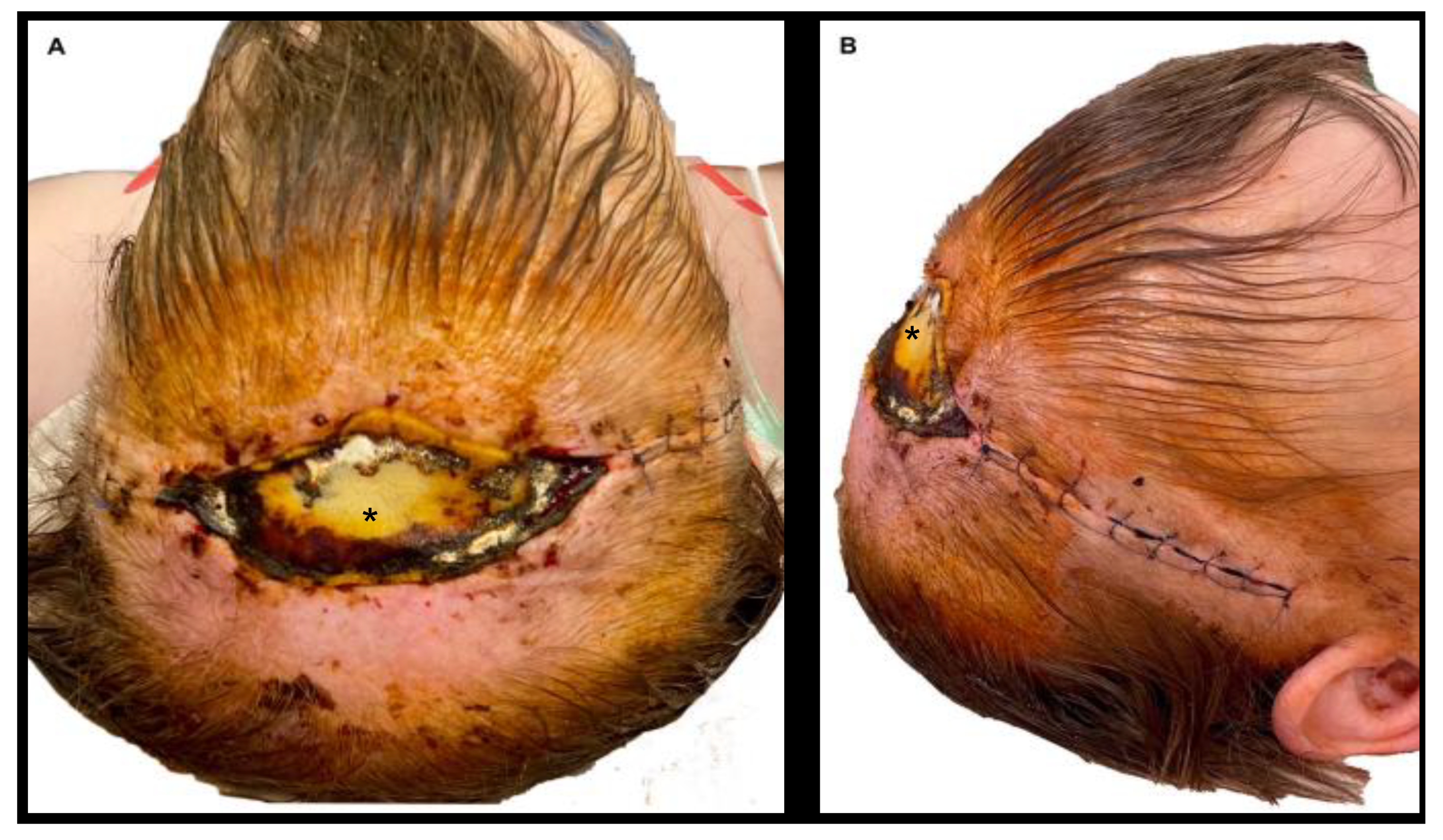 Jcm 11 02600 g006 550