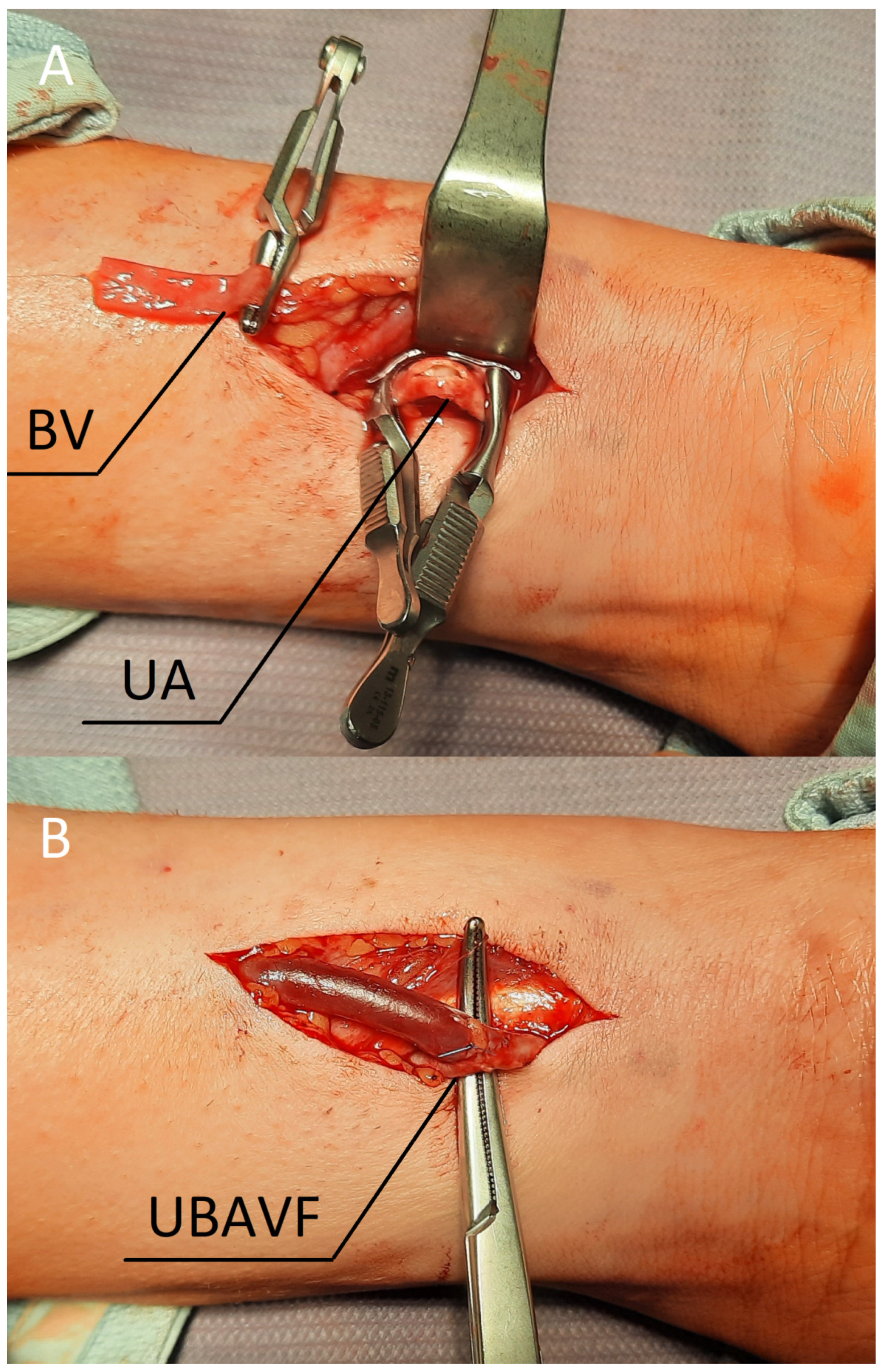 Jcm 11 02610 g002 Jcm 11 02610 g002