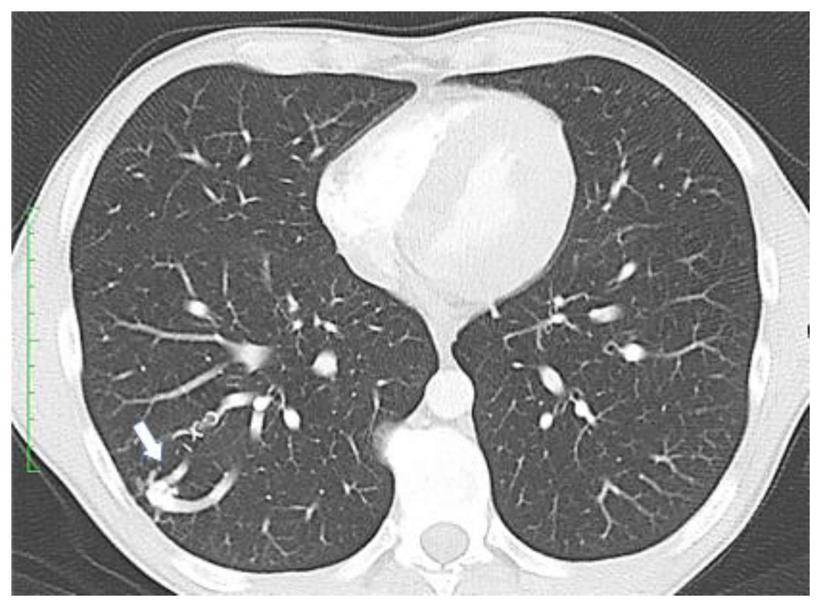 Jcm 11 02634 g002 550