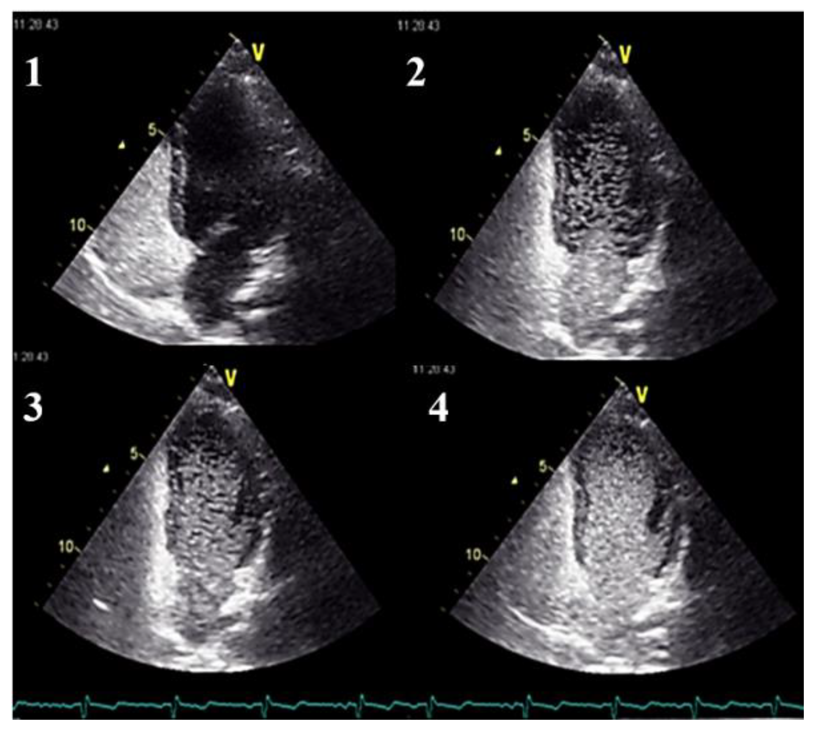 Jcm 11 02634 g003 550