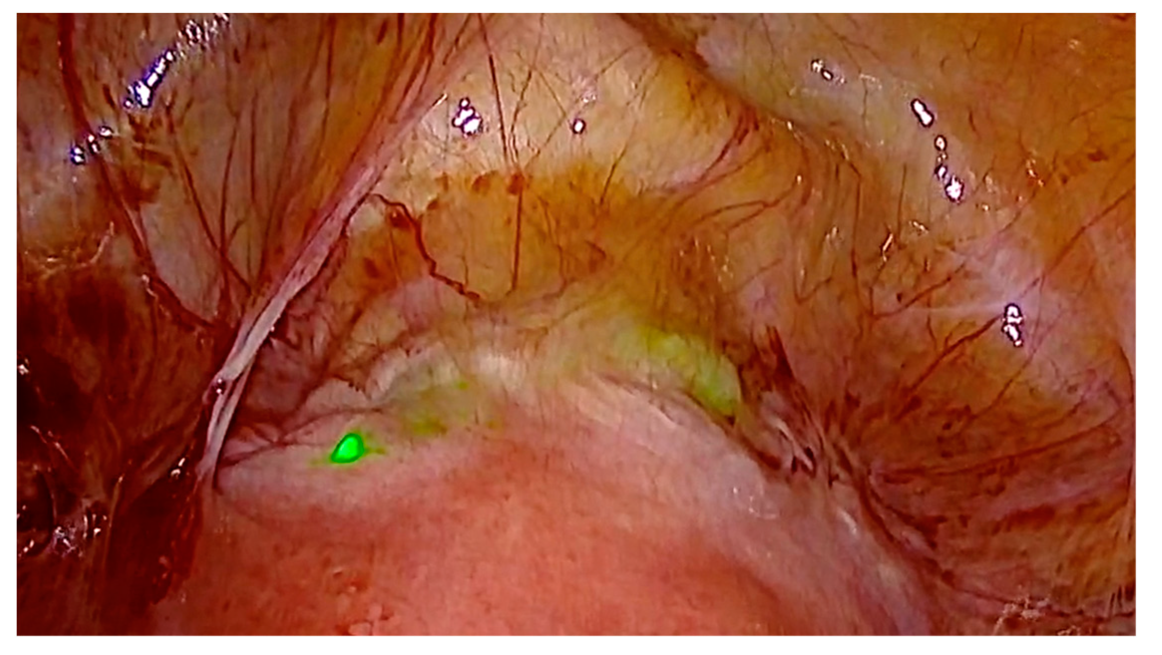 Jcm 11 02657 g001 Jcm 11 02657 g001