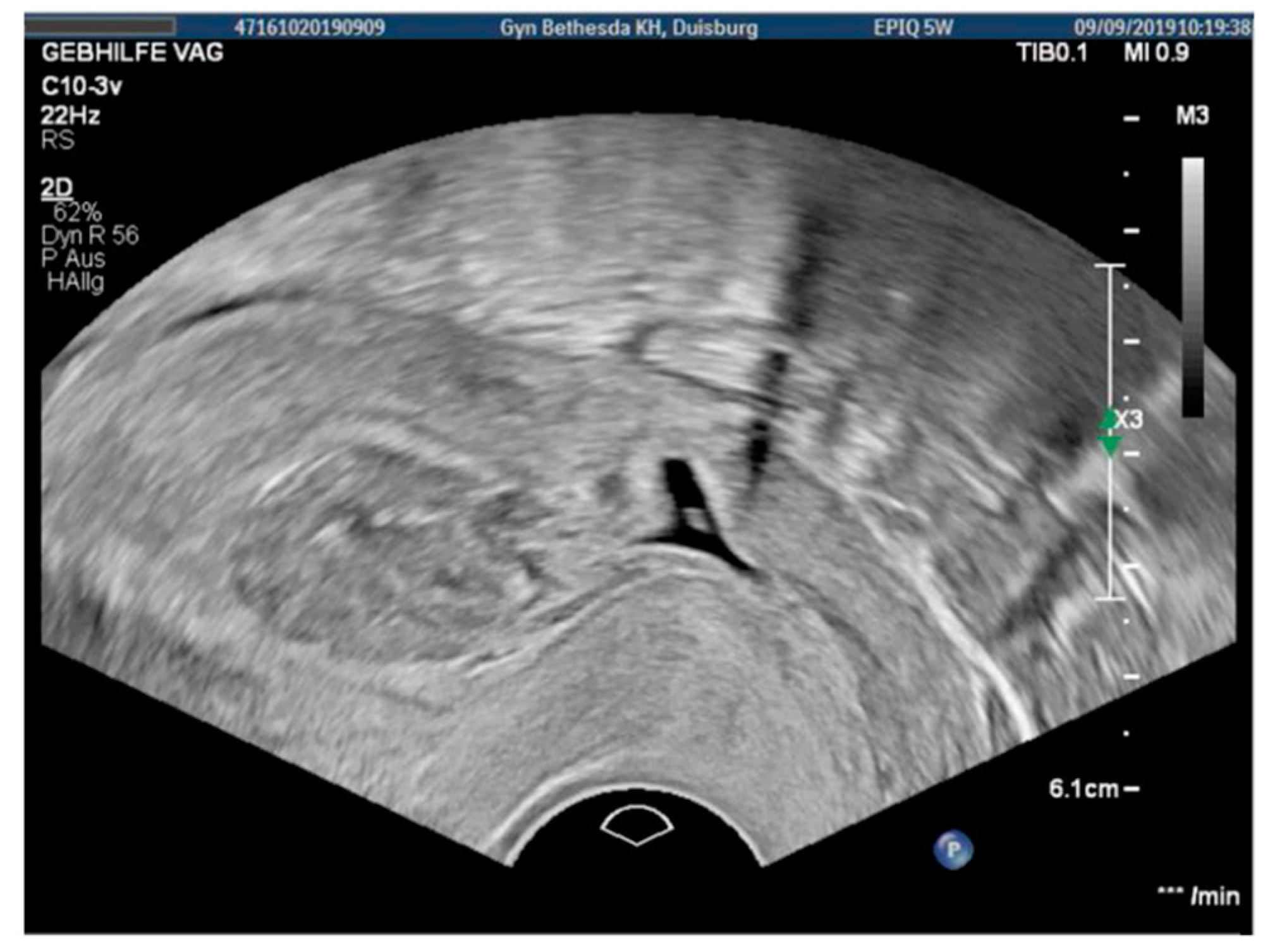 Jcm 11 02657 g002 Jcm 11 02657 g002