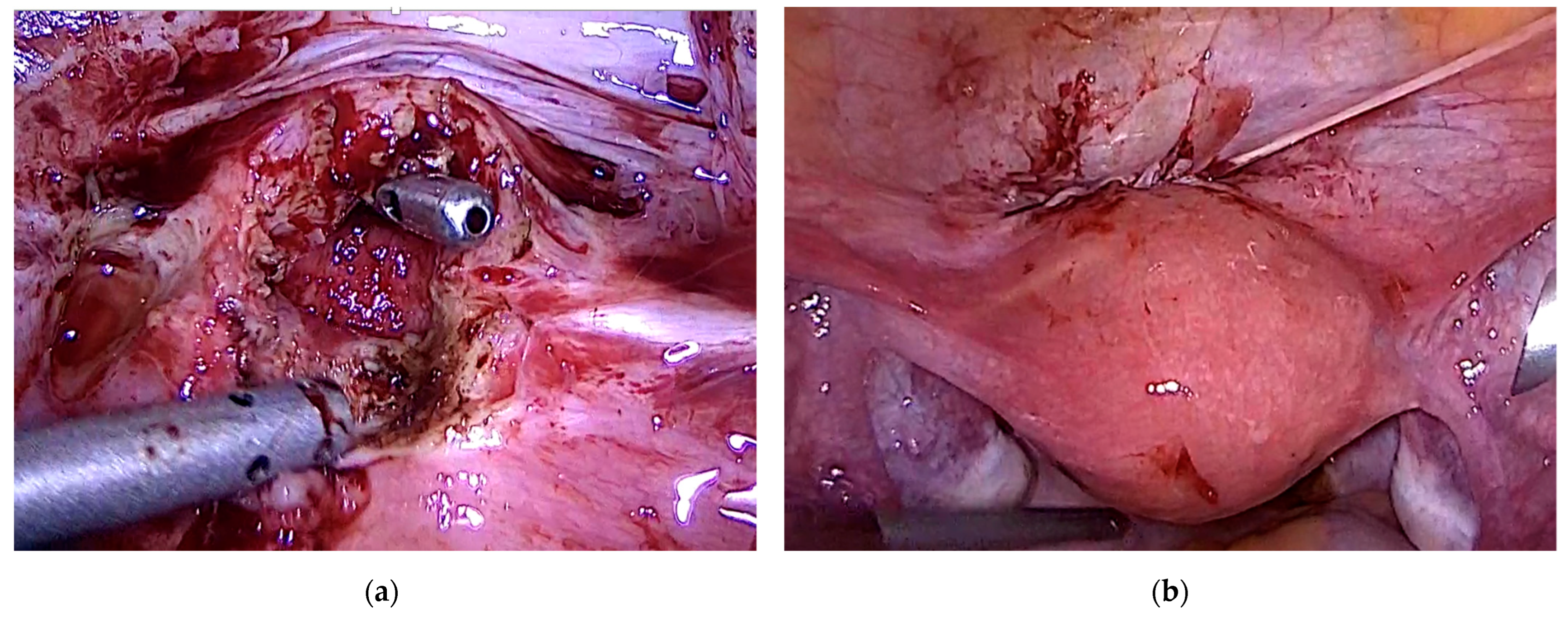 Jcm 11 02657 g004 Jcm 11 02657 g004