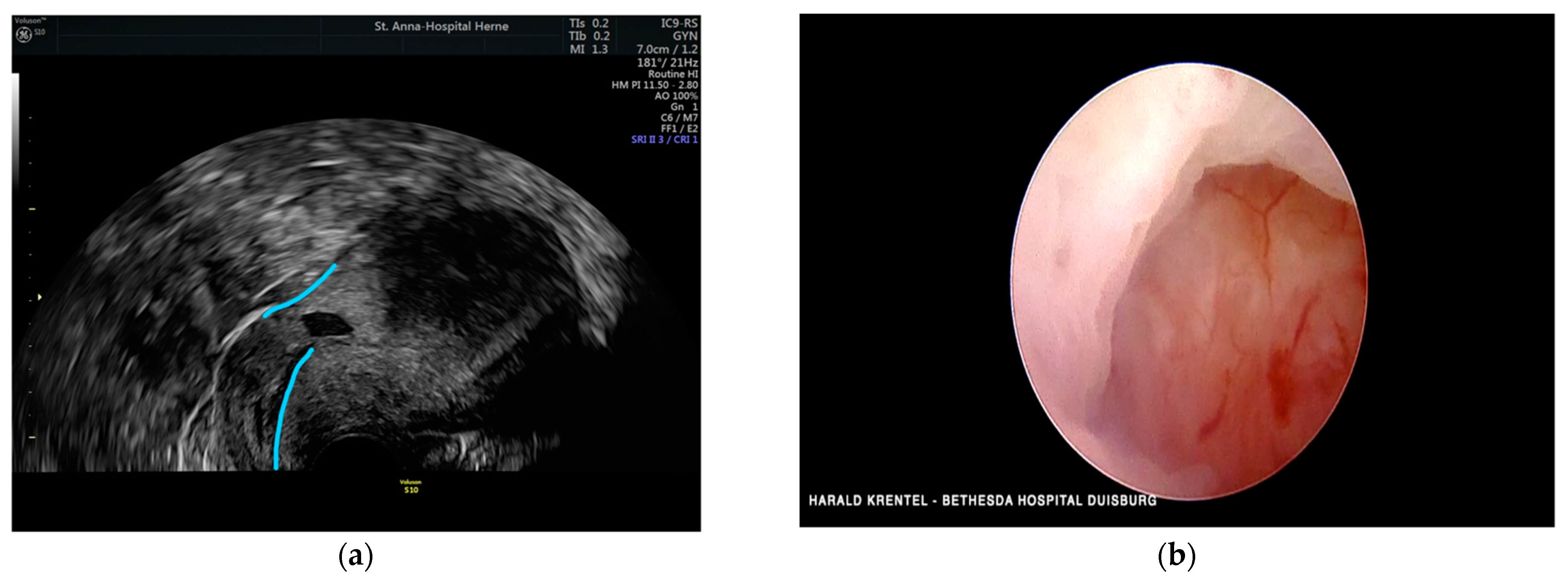 Jcm 11 02657 g005 Jcm 11 02657 g005
