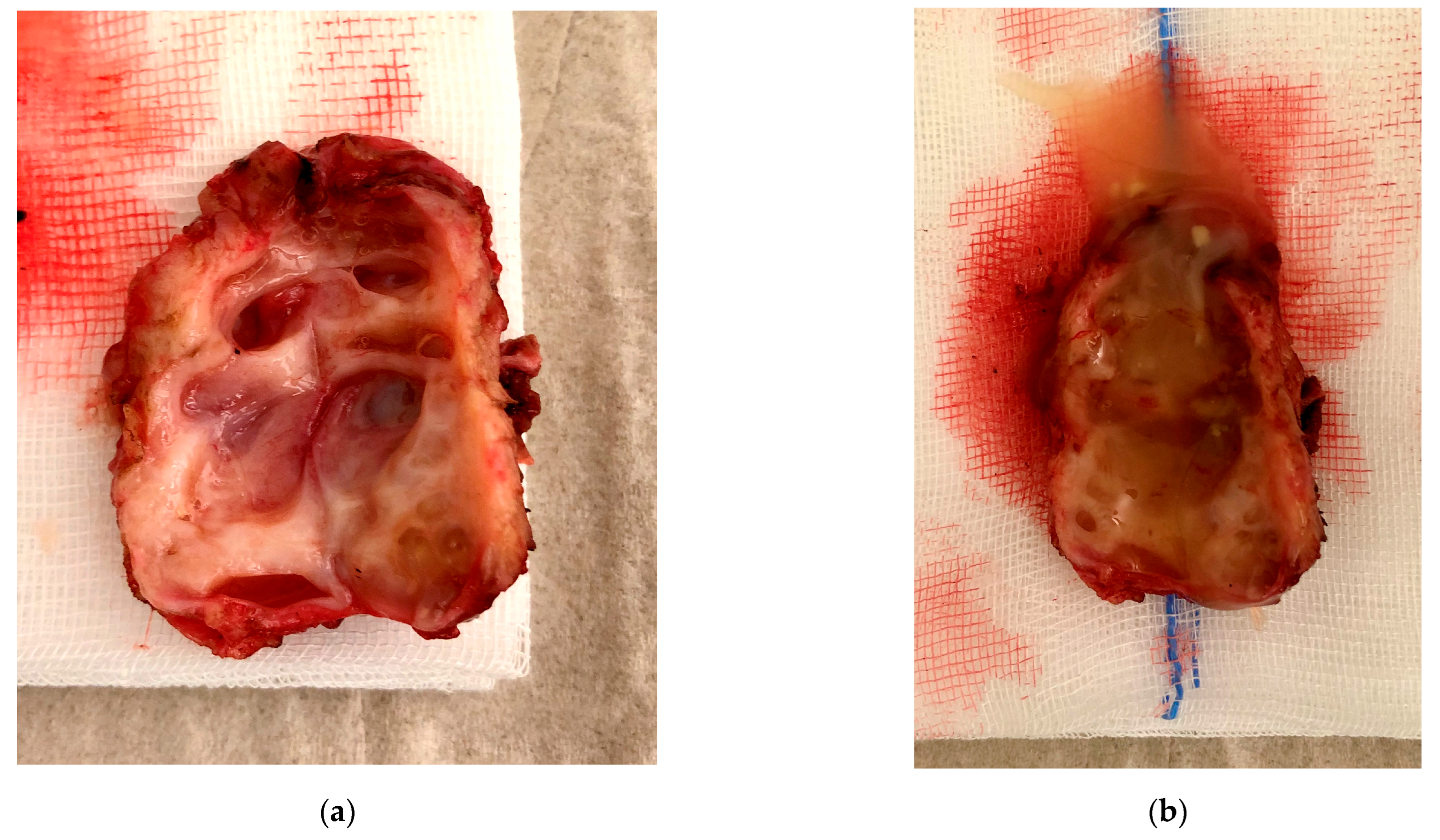 Jcm 11 02657 g007 Jcm 11 02657 g007