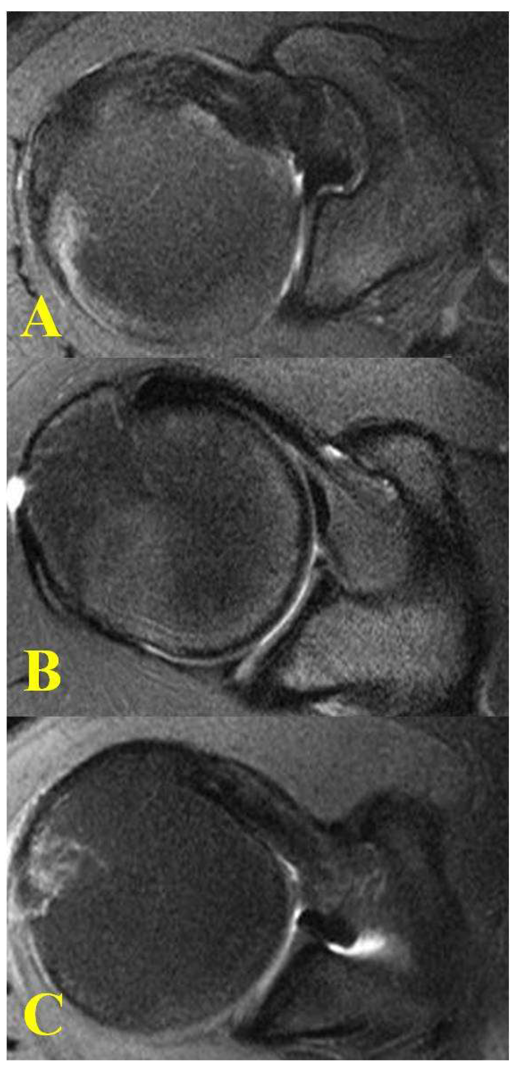Jcm 11 02661 g005 Jcm 11 02661 g005