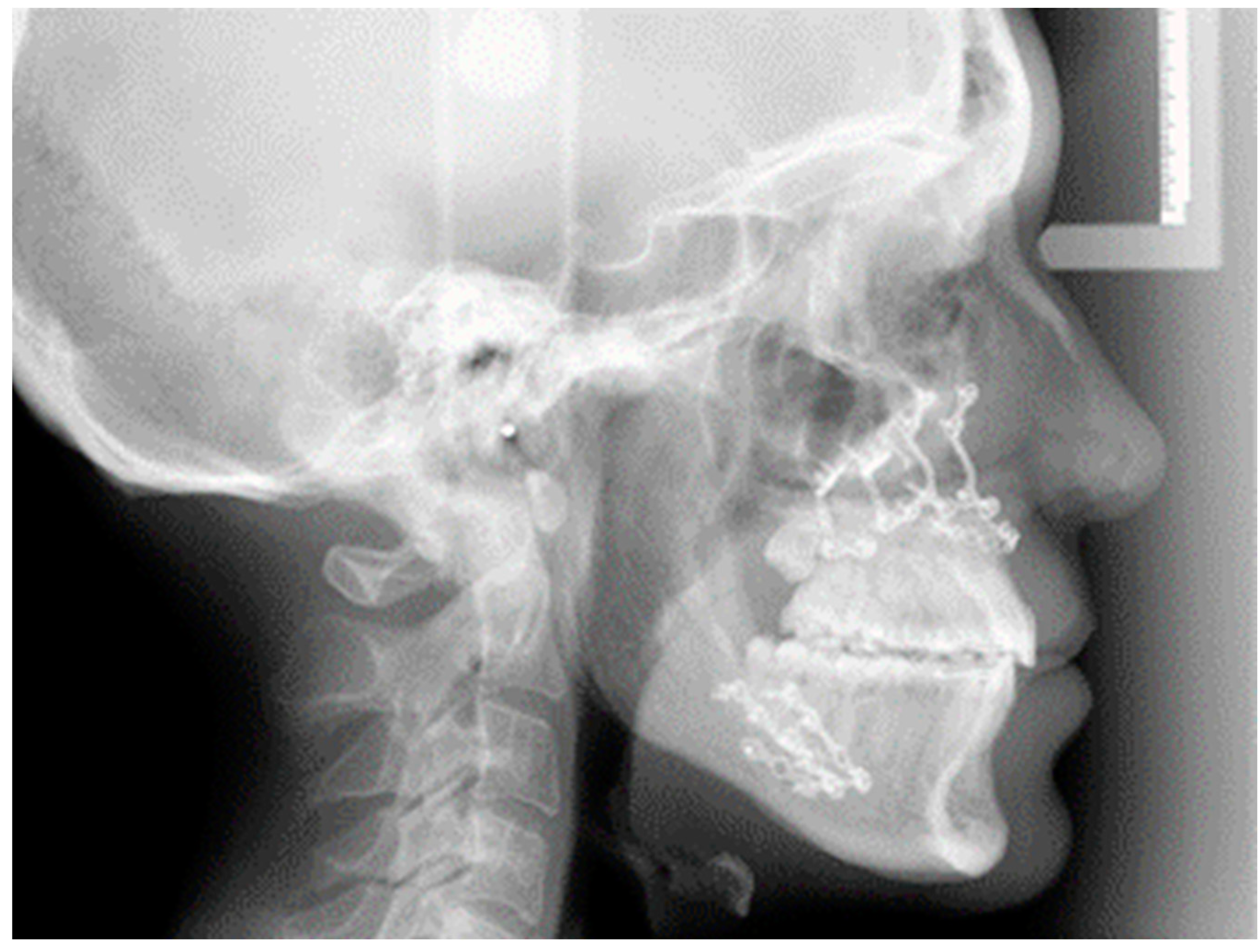 Jcm 11 02675 g003 550