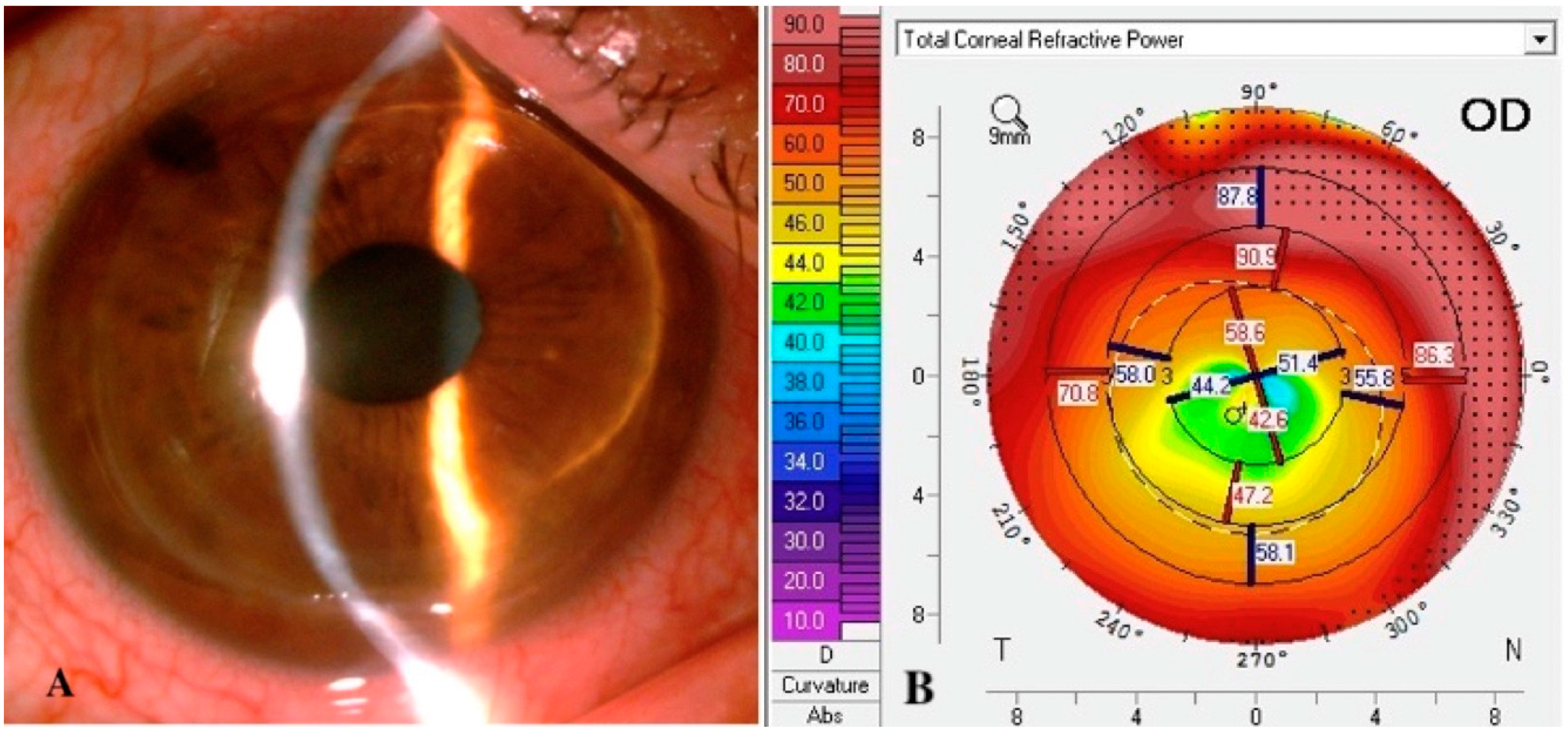 Jcm 11 02678 g002 550