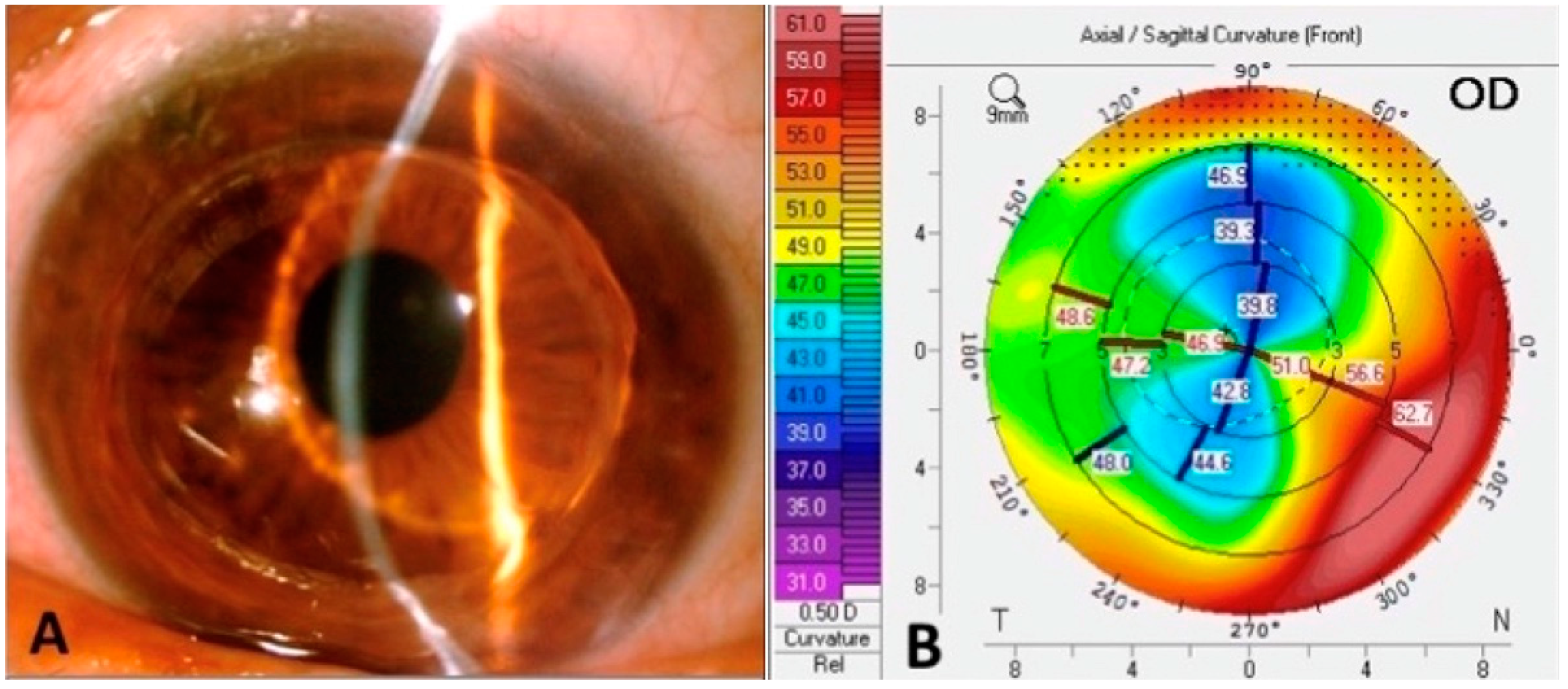 Jcm 11 02678 g003 550